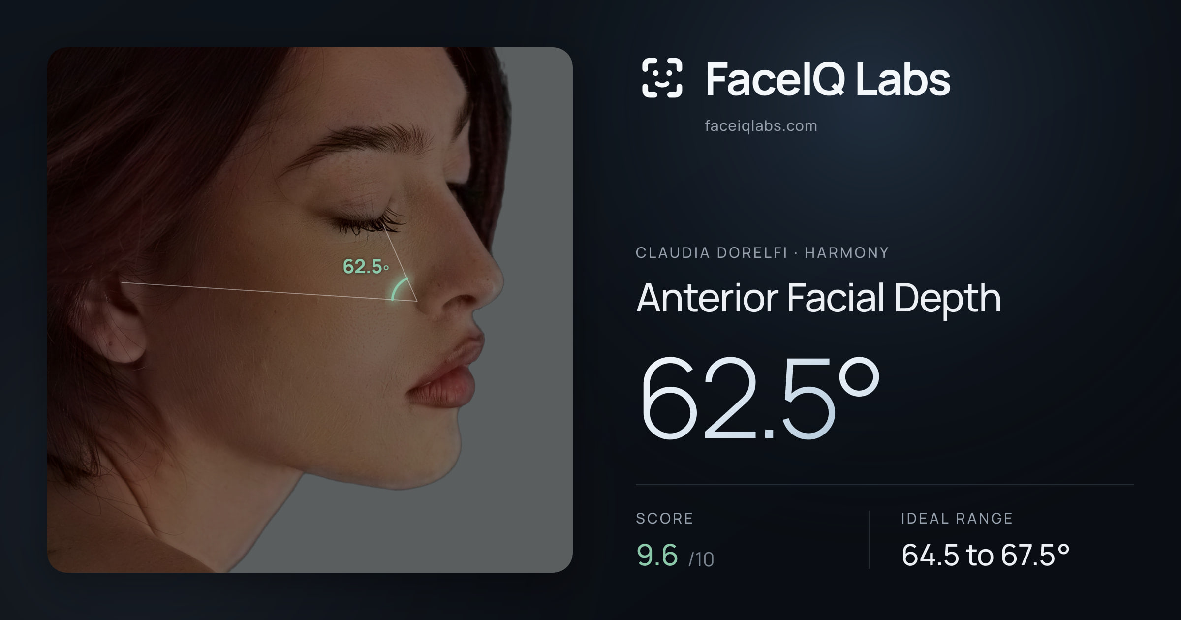 Claudia Dorelfi Anterior Facial Depth: 62.5°, drawn on the photo