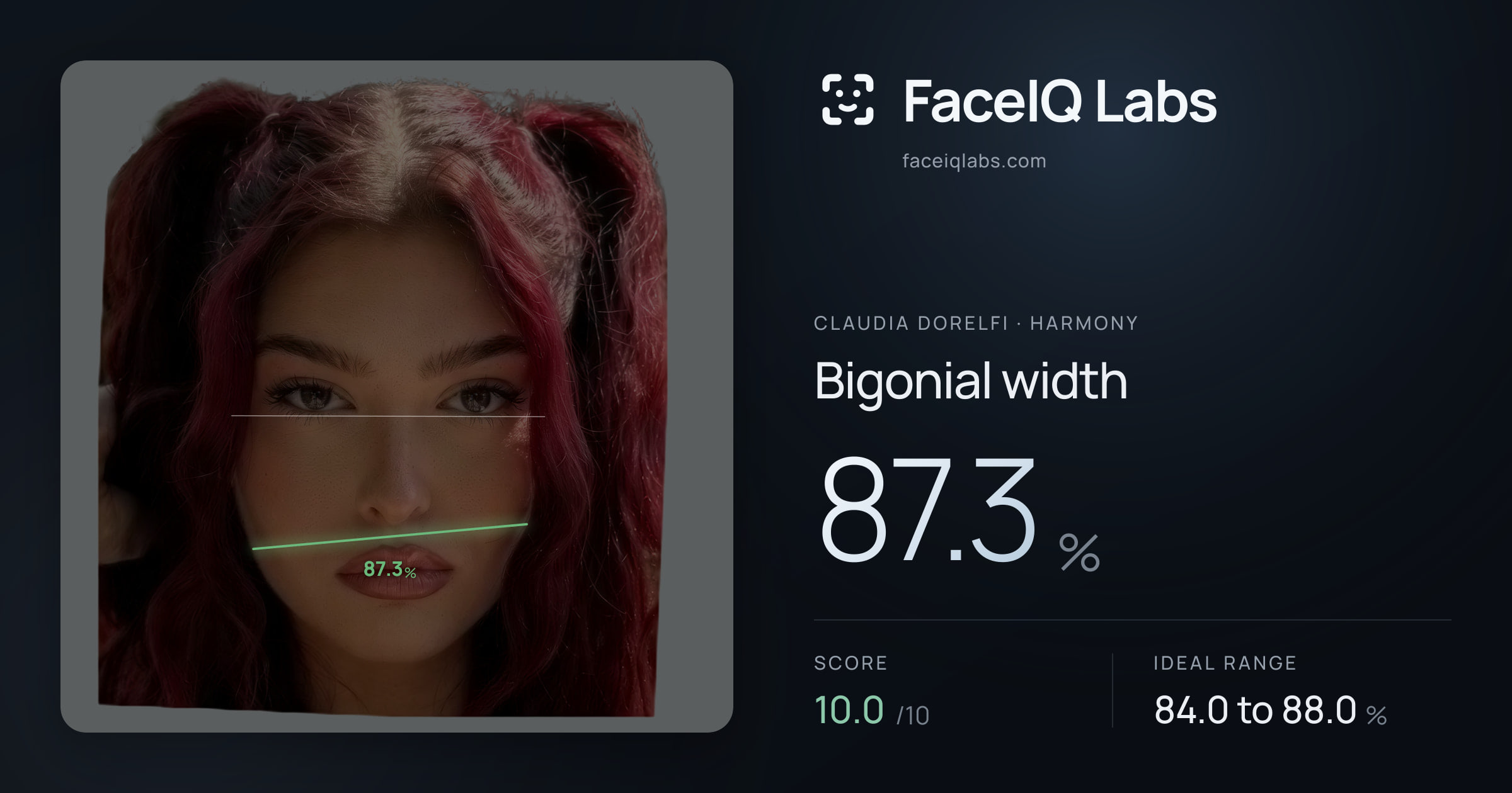 Claudia Dorelfi Bigonial width: 87.3%, drawn on the photo