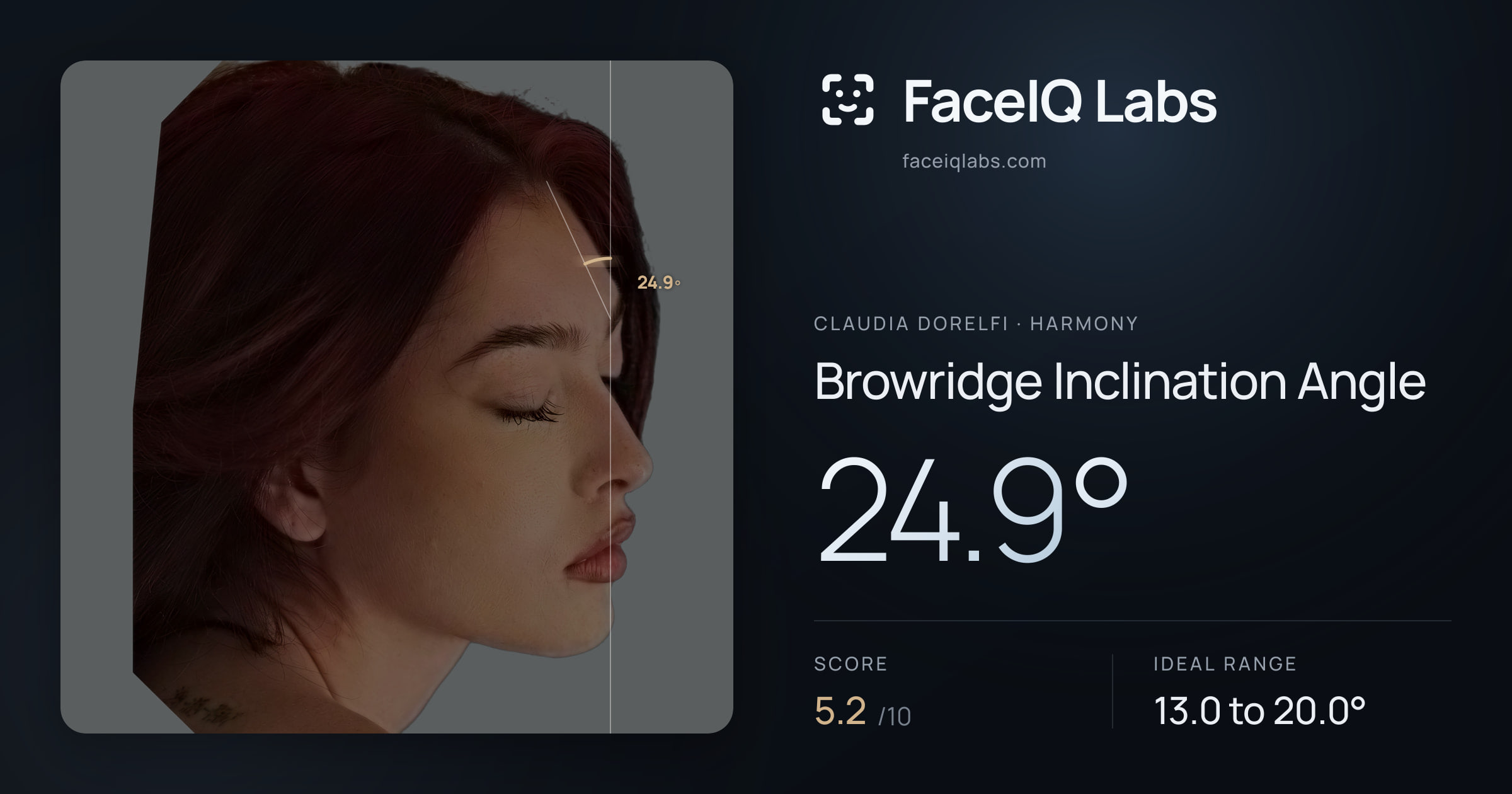 Claudia Dorelfi Browridge Inclination Angle: 24.9°, drawn on the photo