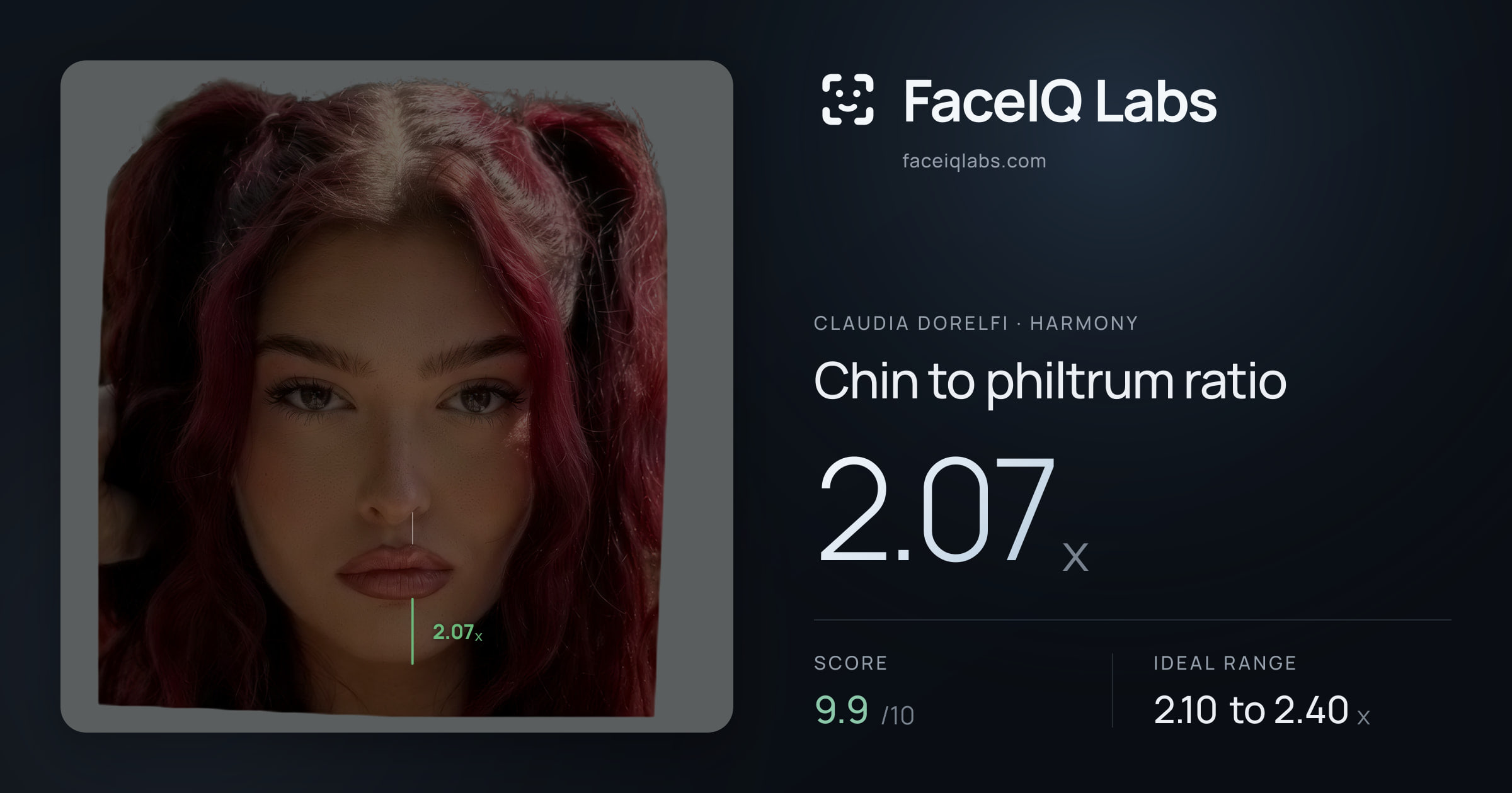 Claudia Dorelfi Chin to philtrum ratio: 2.07x, drawn on the photo