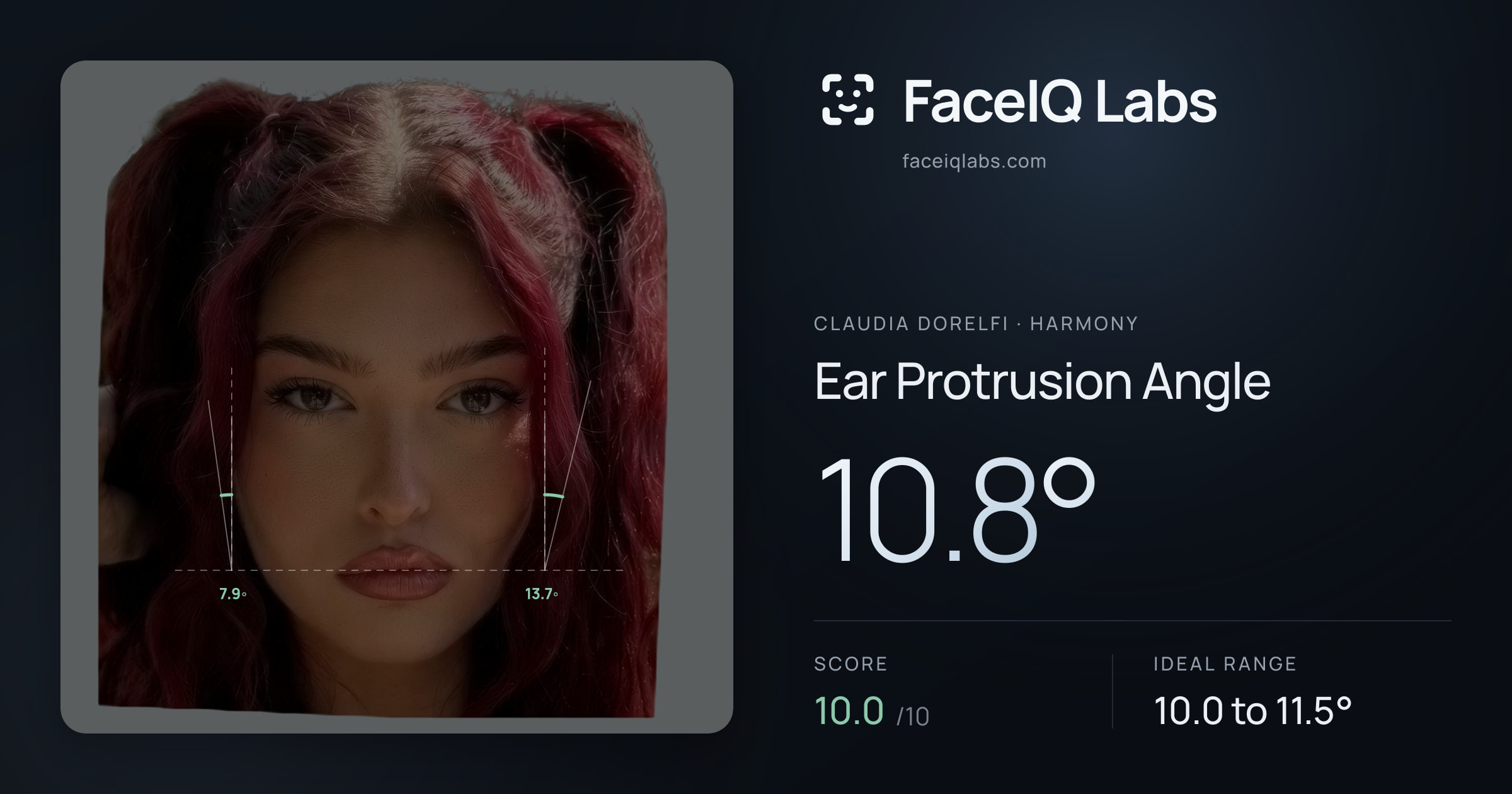 Claudia Dorelfi Ear Protrusion Angle: 10.8°, drawn on the photo