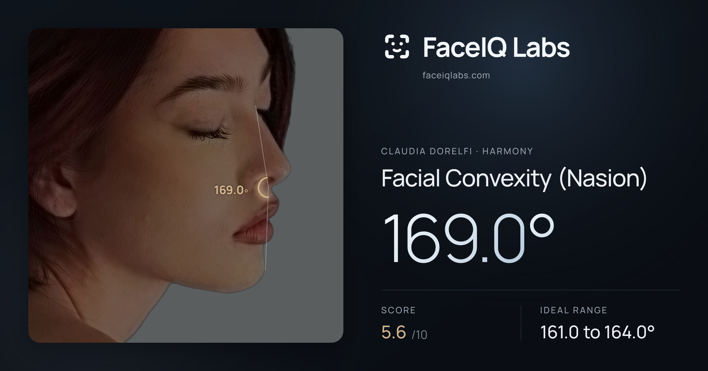 Claudia Dorelfi Facial Convexity (Nasion): 169.0°, drawn on the photo
