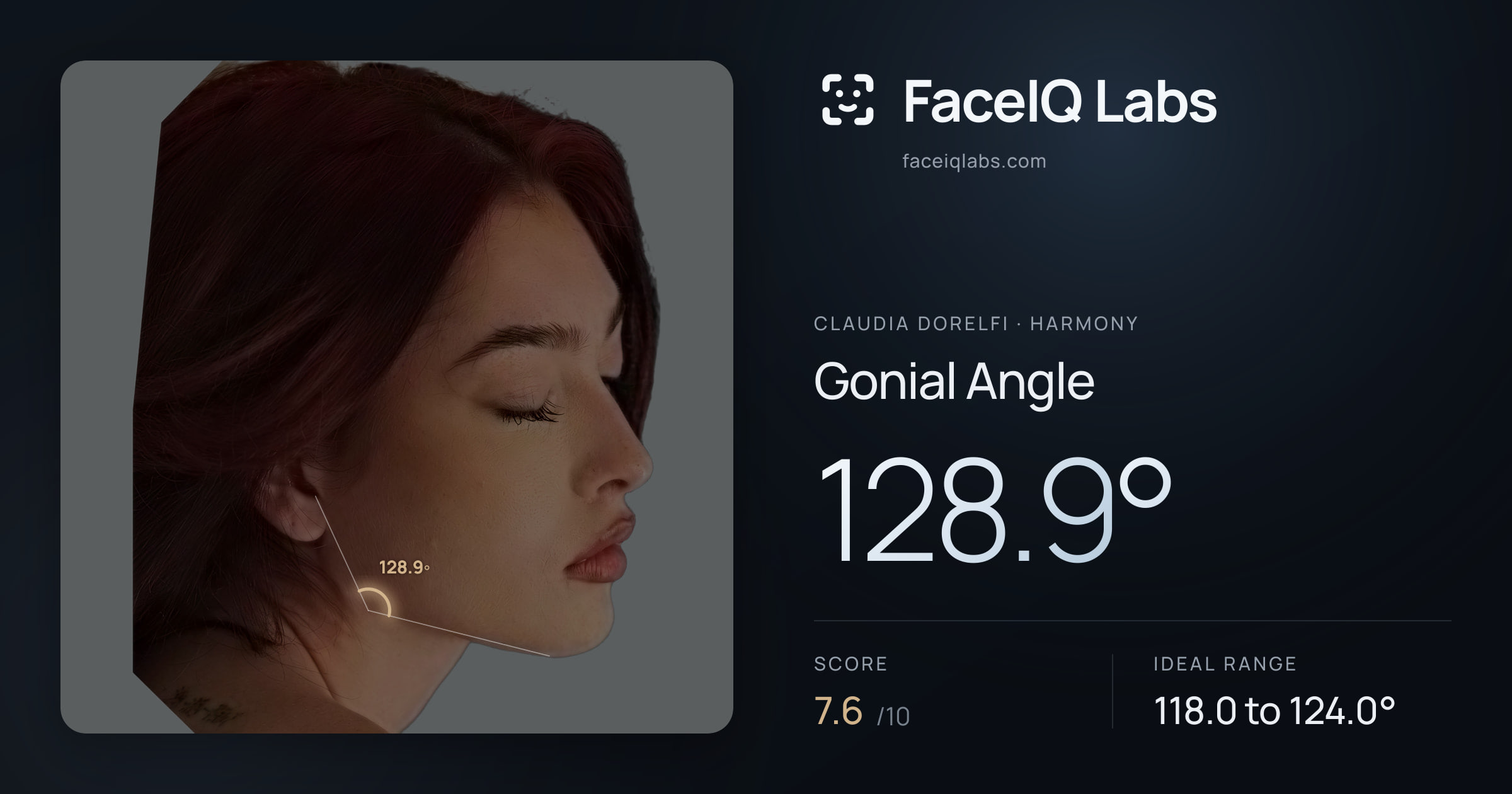 Claudia Dorelfi Gonial Angle: 128.9°, drawn on the photo