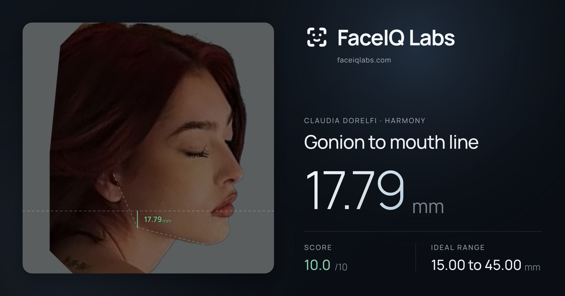 Claudia Dorelfi Gonion to mouth line: 17.79mm, drawn on the photo