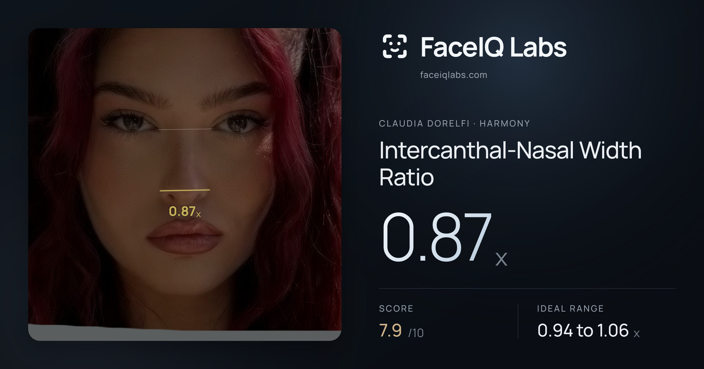 Claudia Dorelfi Intercanthal-Nasal Width Ratio: 0.87x, drawn on the photo