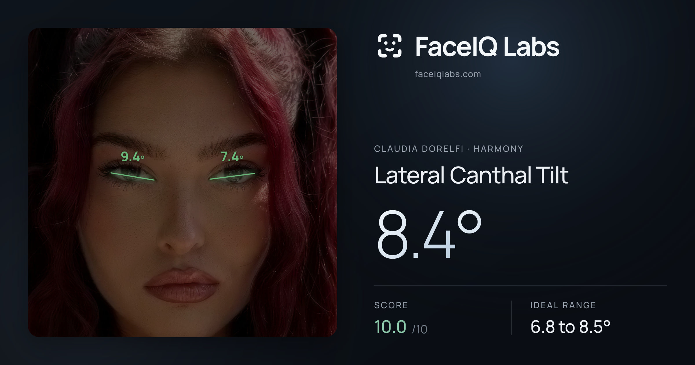 Claudia Dorelfi Lateral Canthal Tilt: 8.4°, drawn on the photo