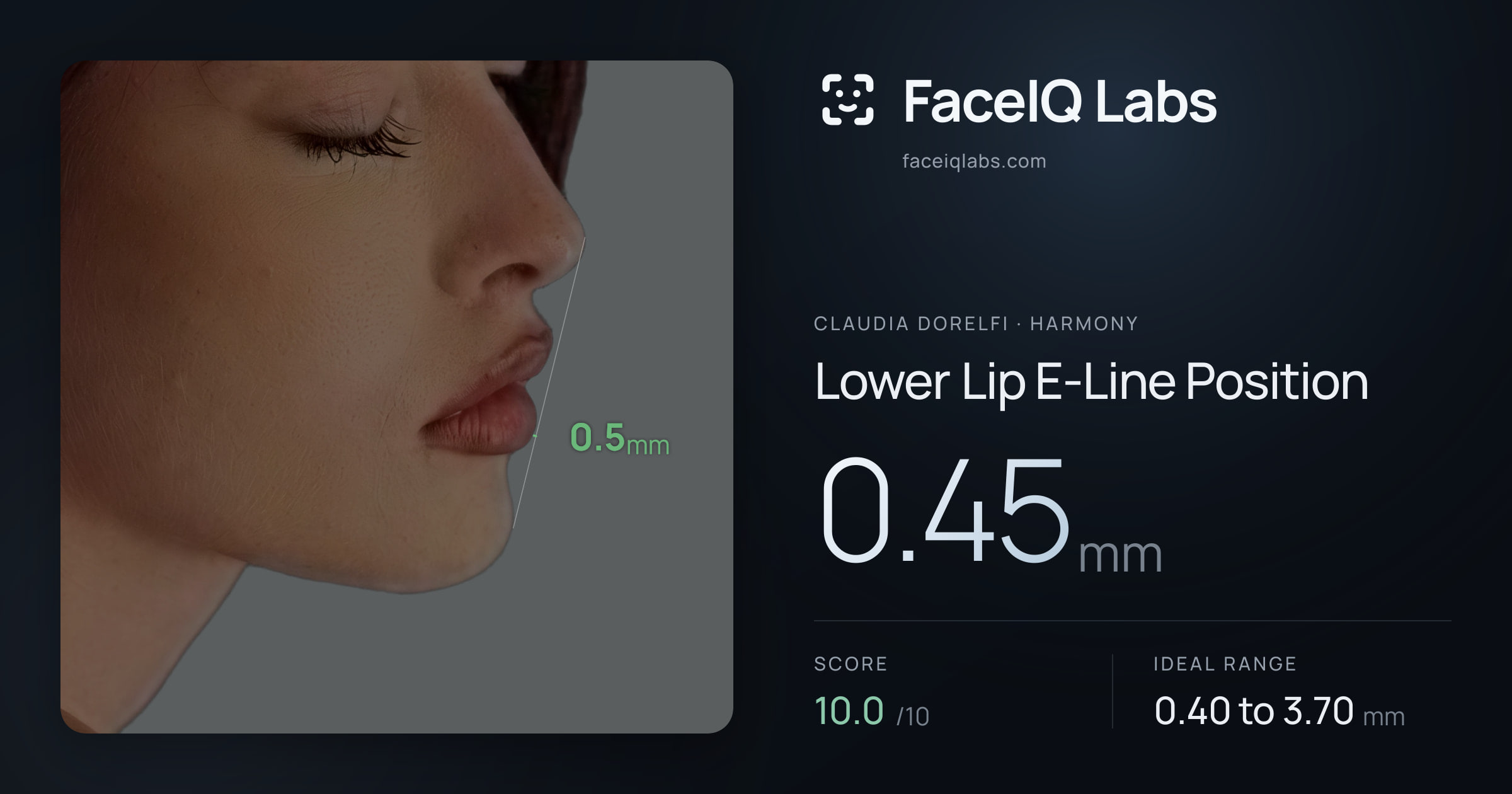 Claudia Dorelfi Lower Lip E-Line Position: 0.45mm, drawn on the photo