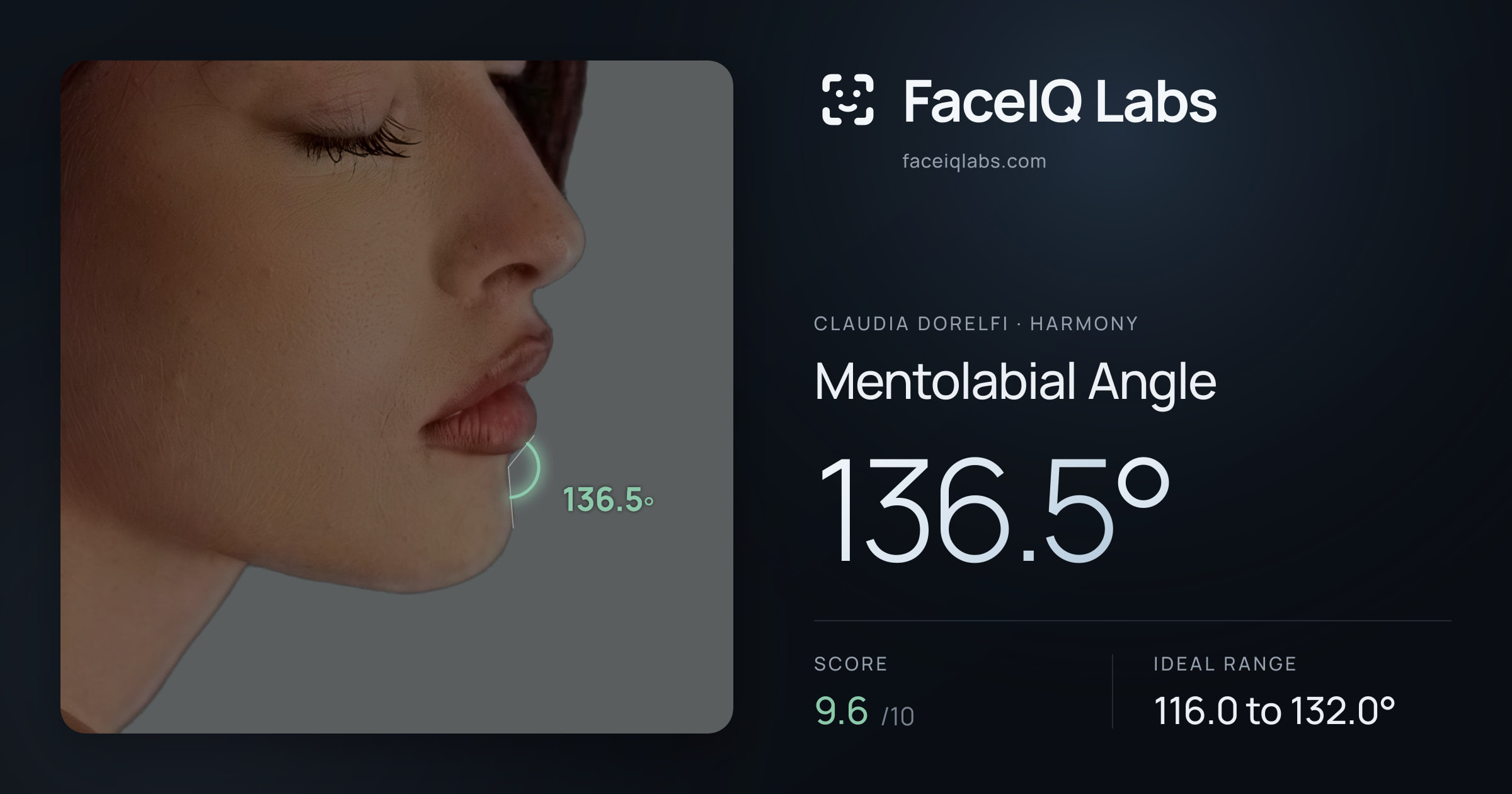 Claudia Dorelfi Mentolabial Angle: 136.5°, drawn on the photo
