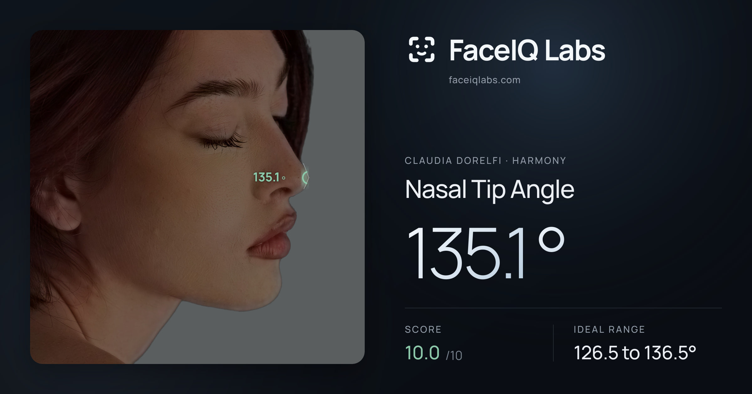 Claudia Dorelfi Nasal Tip Angle: 135.1°, drawn on the photo