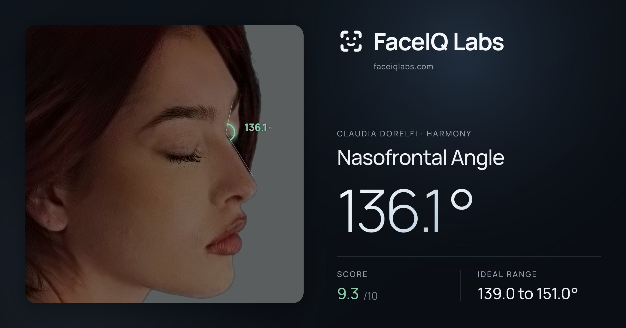Claudia Dorelfi Nasofrontal Angle: 136.1°, drawn on the photo