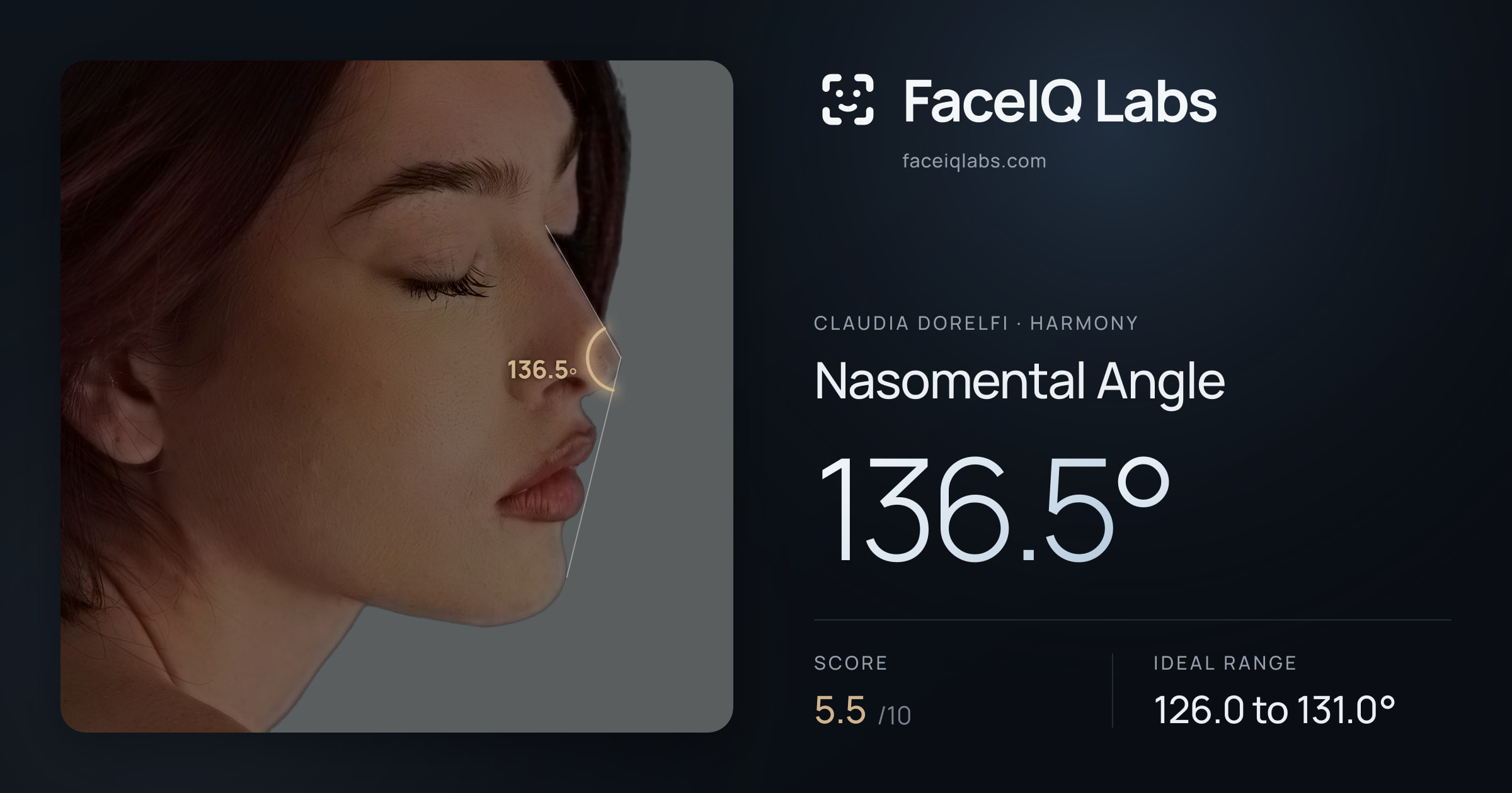 Claudia Dorelfi Nasomental Angle: 136.5°, drawn on the photo