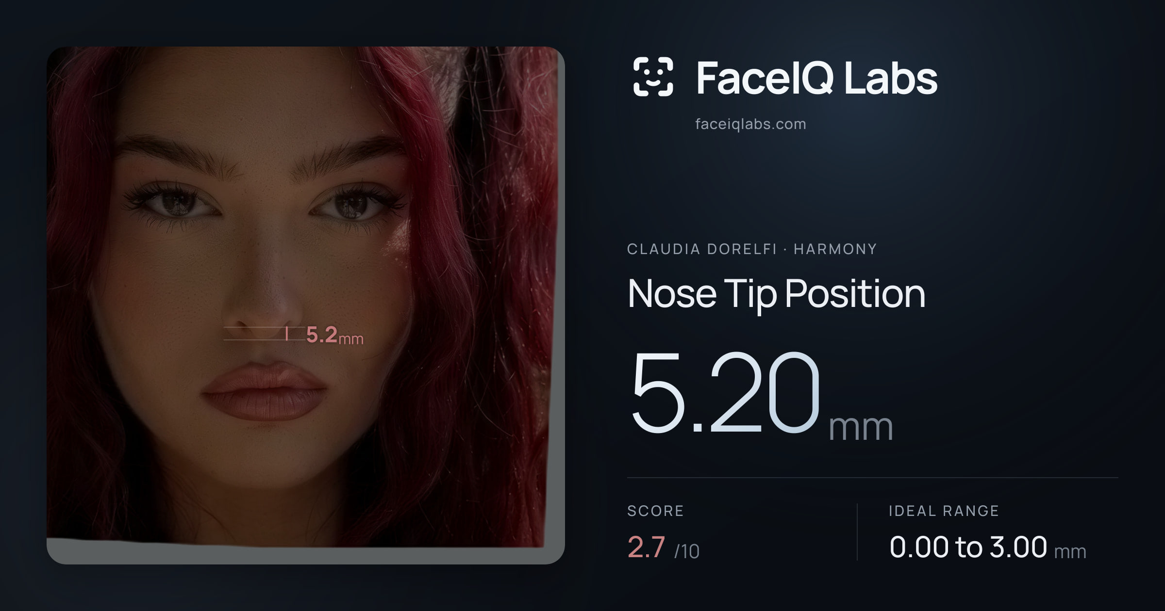 Claudia Dorelfi Nose Tip Position: 5.20mm, drawn on the photo