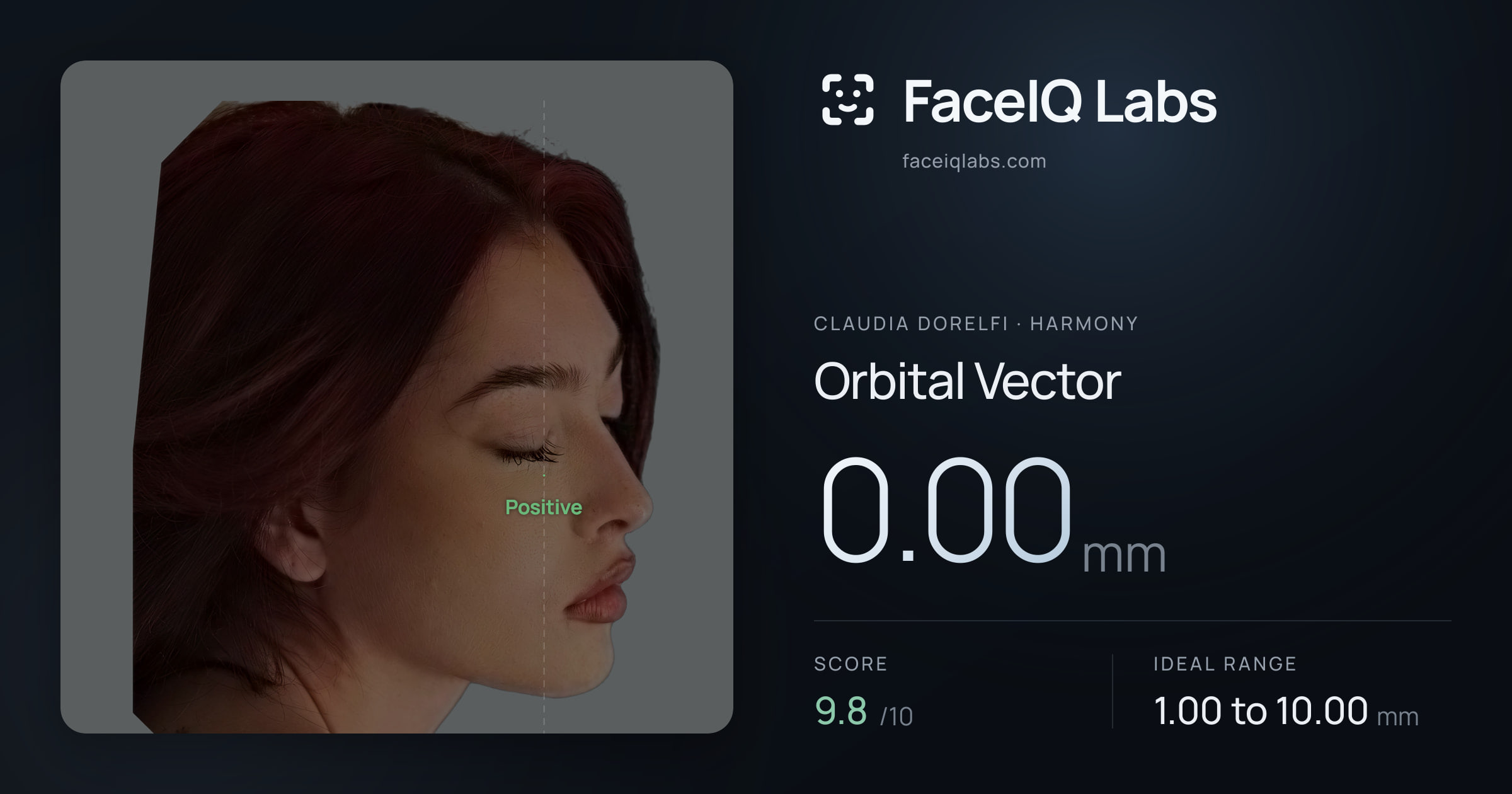 Claudia Dorelfi Orbital Vector: 0.00mm, drawn on the photo