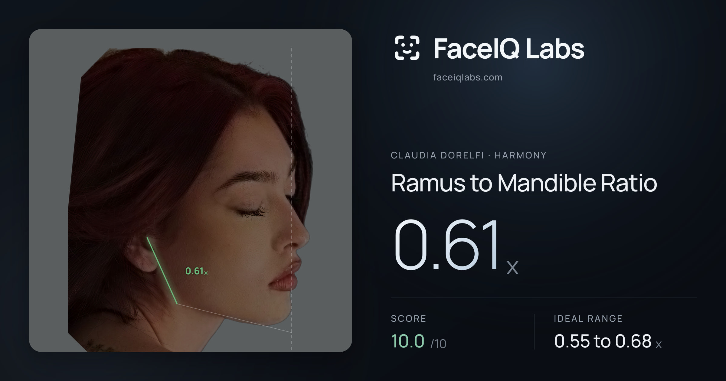 Claudia Dorelfi Ramus to Mandible Ratio: 0.61x, drawn on the photo