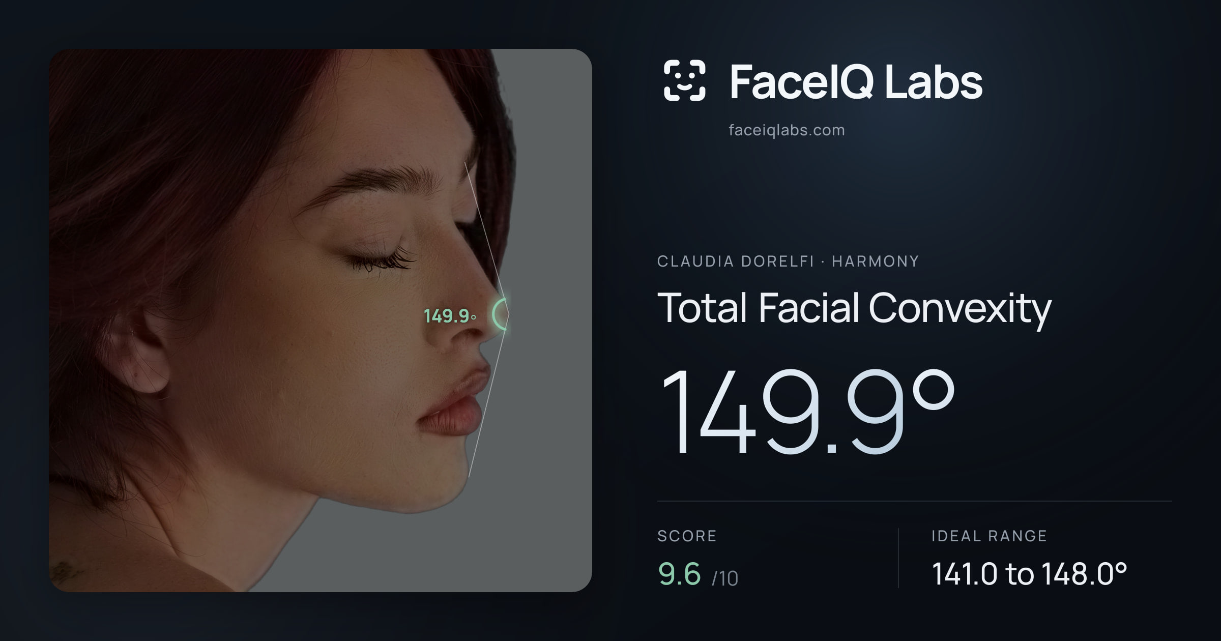 Claudia Dorelfi Total Facial Convexity: 149.9°, drawn on the photo