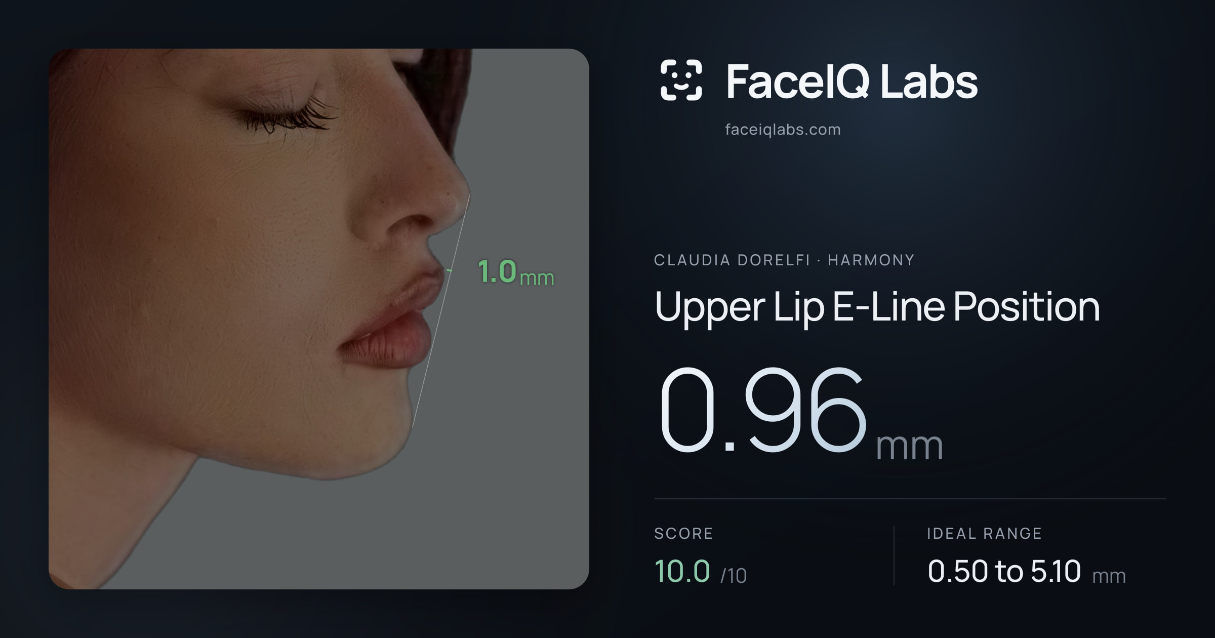 Claudia Dorelfi Upper Lip E-Line Position: 0.96mm, drawn on the photo