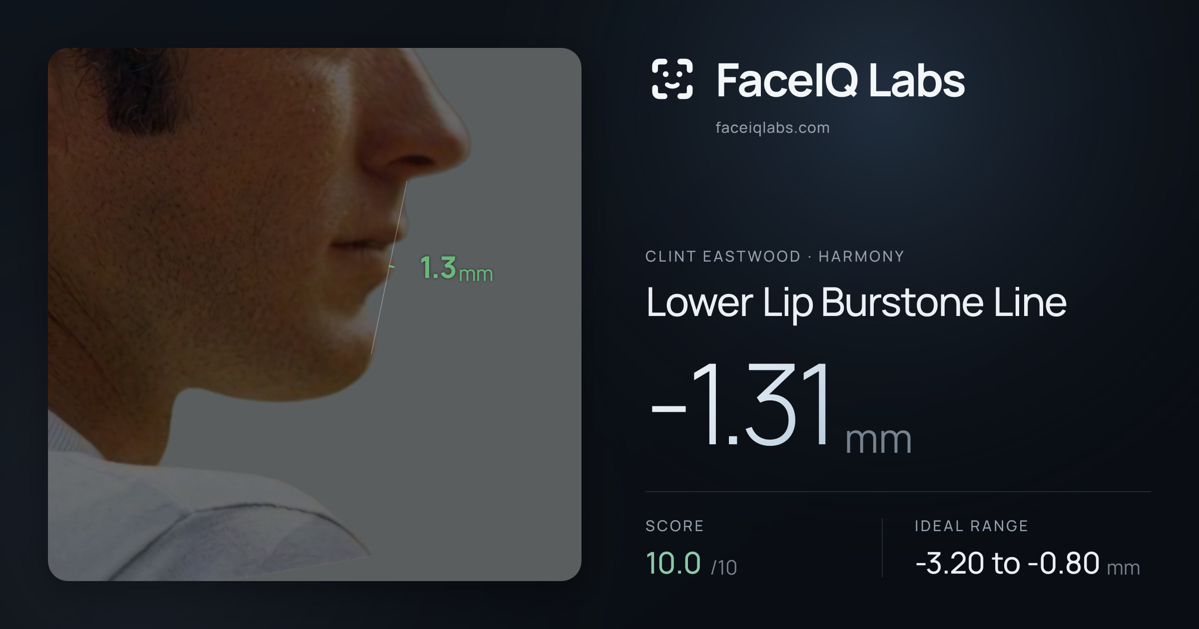 Clint Eastwood Lower Lip Burstone Line: -1.31mm, drawn on the photo