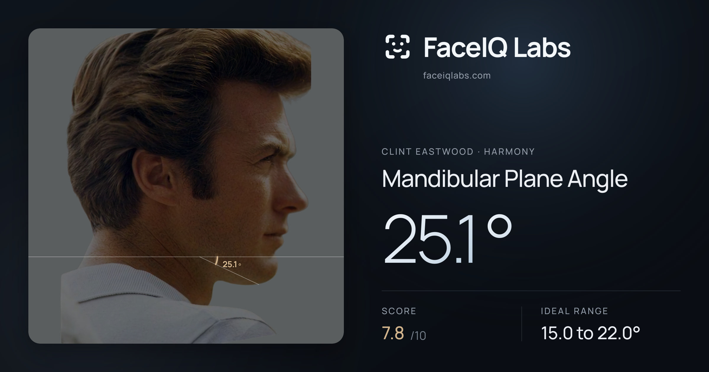 Clint Eastwood Mandibular Plane Angle: 25.1°, drawn on the photo