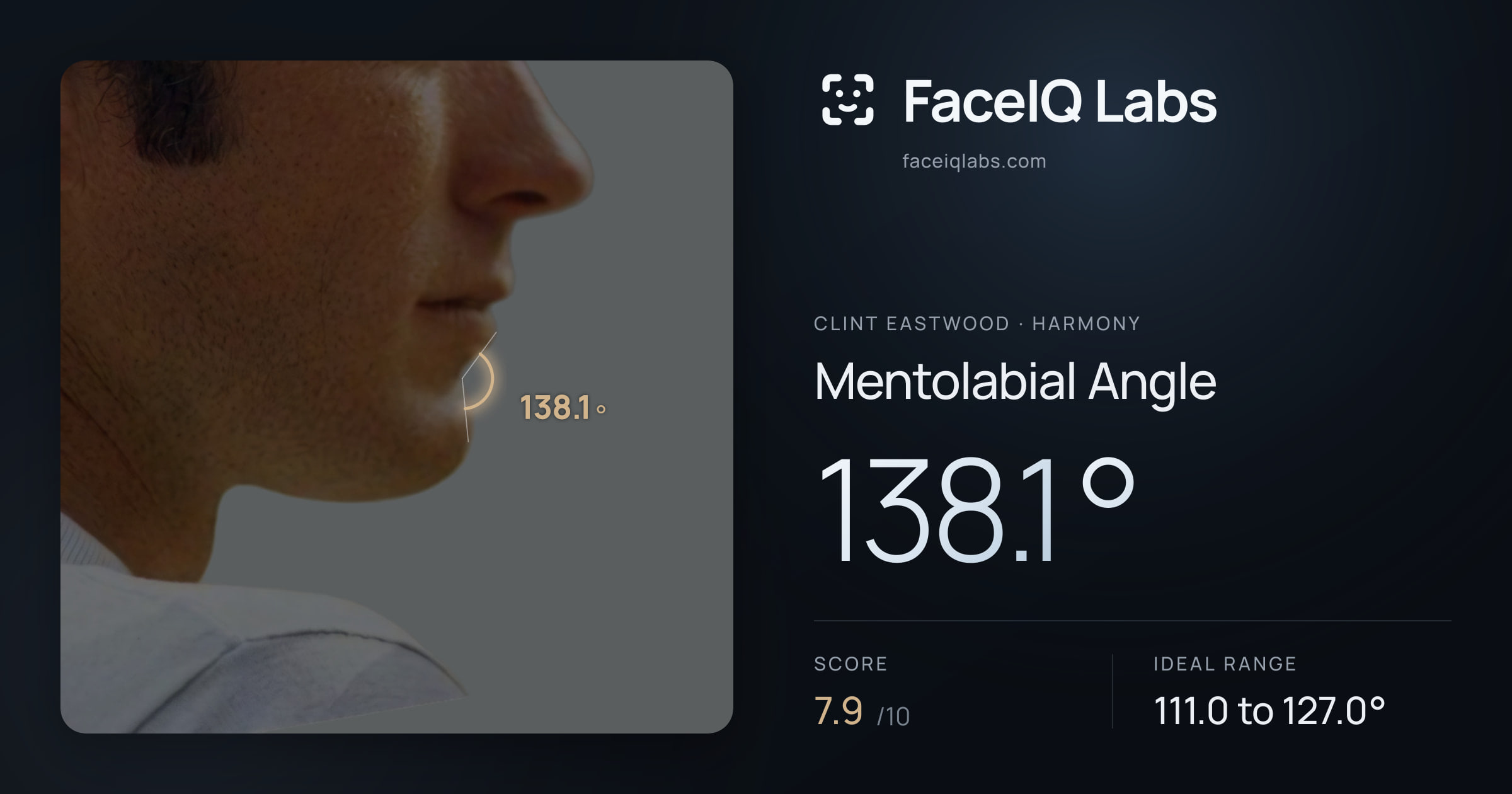 Clint Eastwood Mentolabial Angle: 138.1°, drawn on the photo