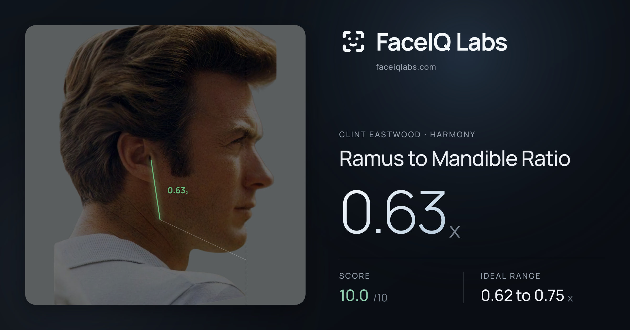 Clint Eastwood Ramus to Mandible Ratio: 0.63x, drawn on the photo
