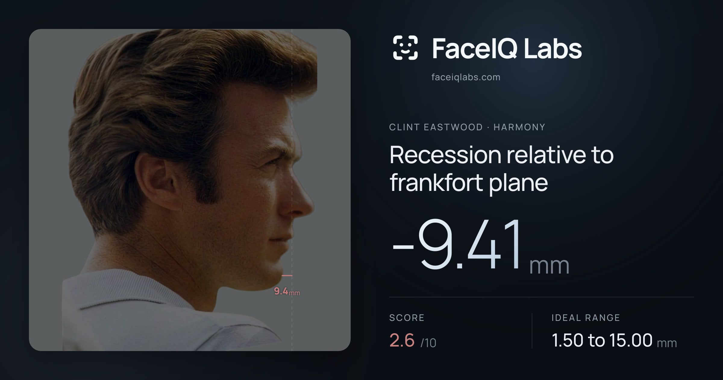 Clint Eastwood Recession relative to frankfort plane: -9.41mm, drawn on the photo