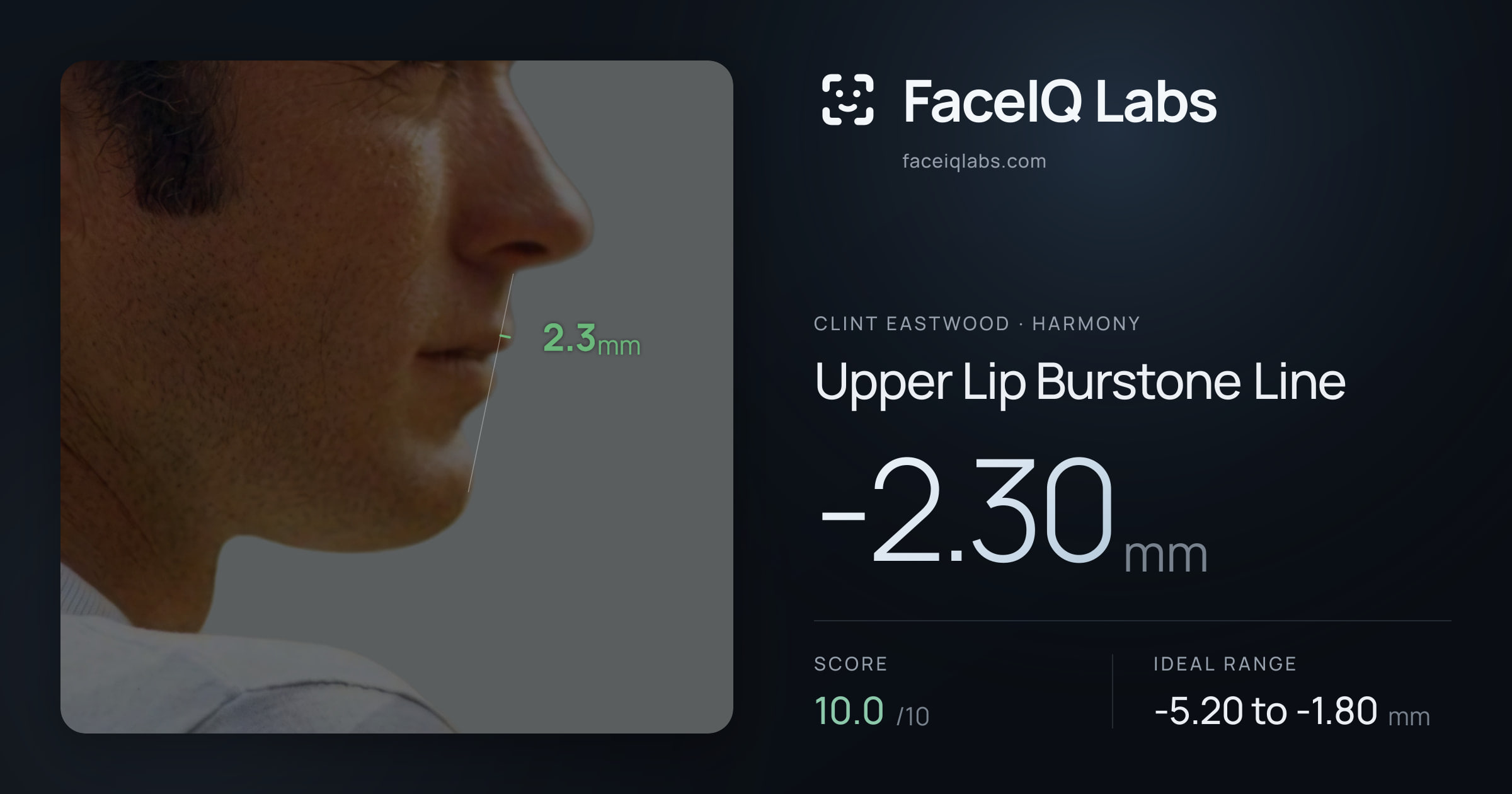 Clint Eastwood Upper Lip Burstone Line: -2.30mm, drawn on the photo