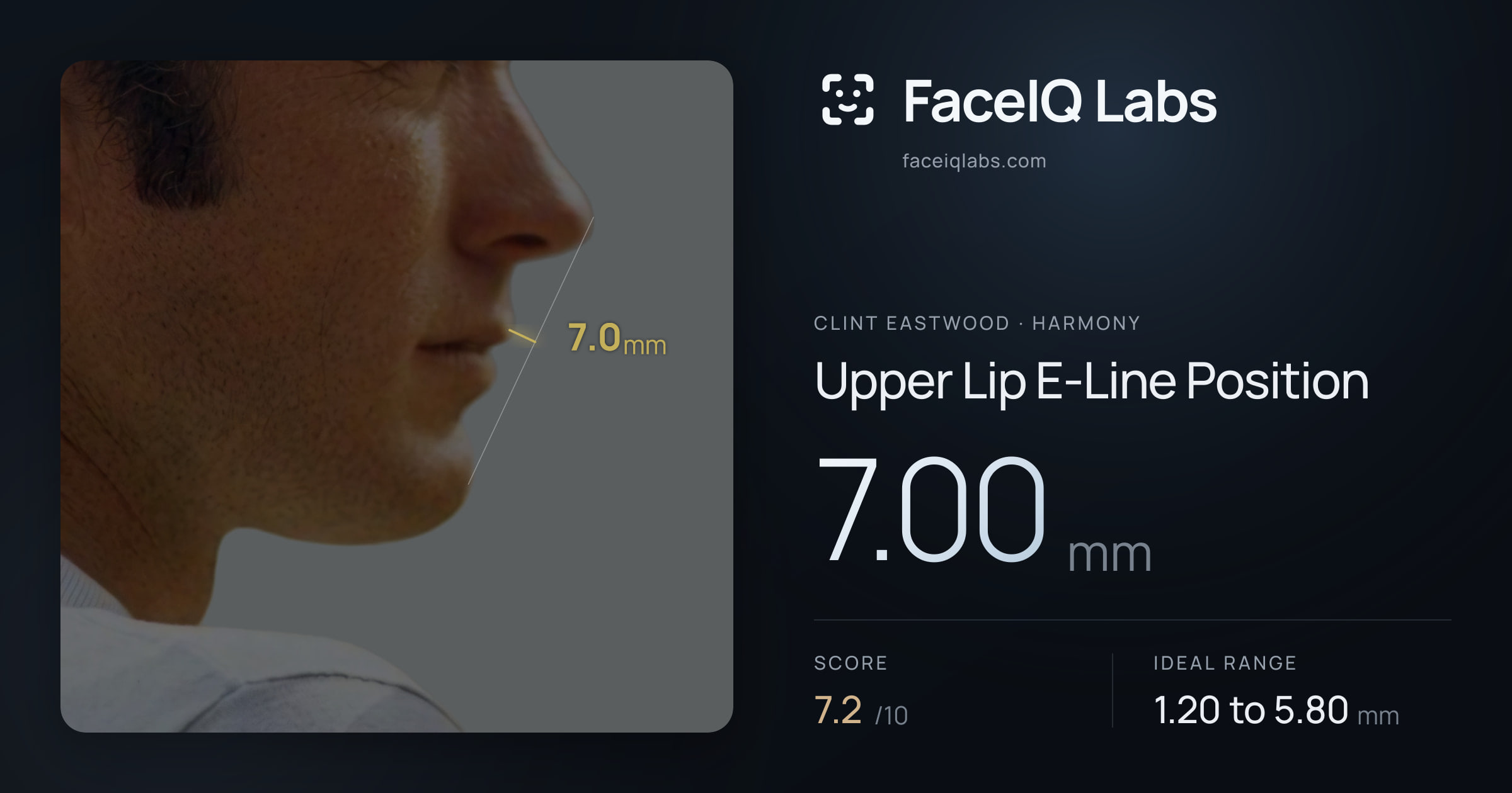 Clint Eastwood Upper Lip E-Line Position: 7.00mm, drawn on the photo