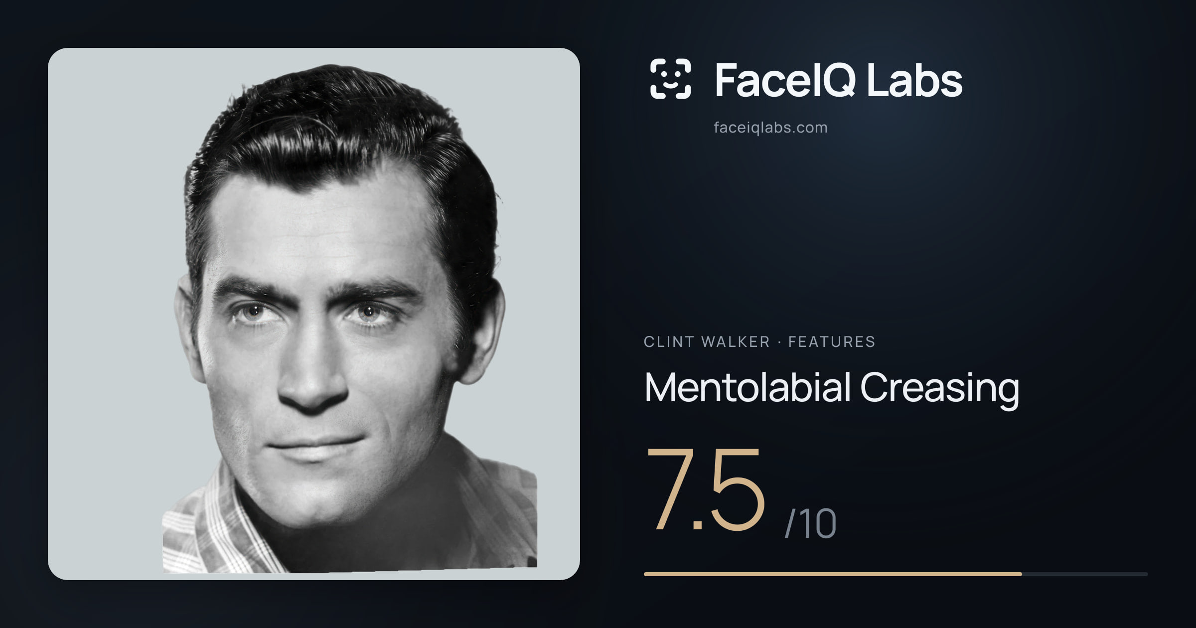 Clint Walker Mentolabial Creasing: 7.5/10, drawn on the photo