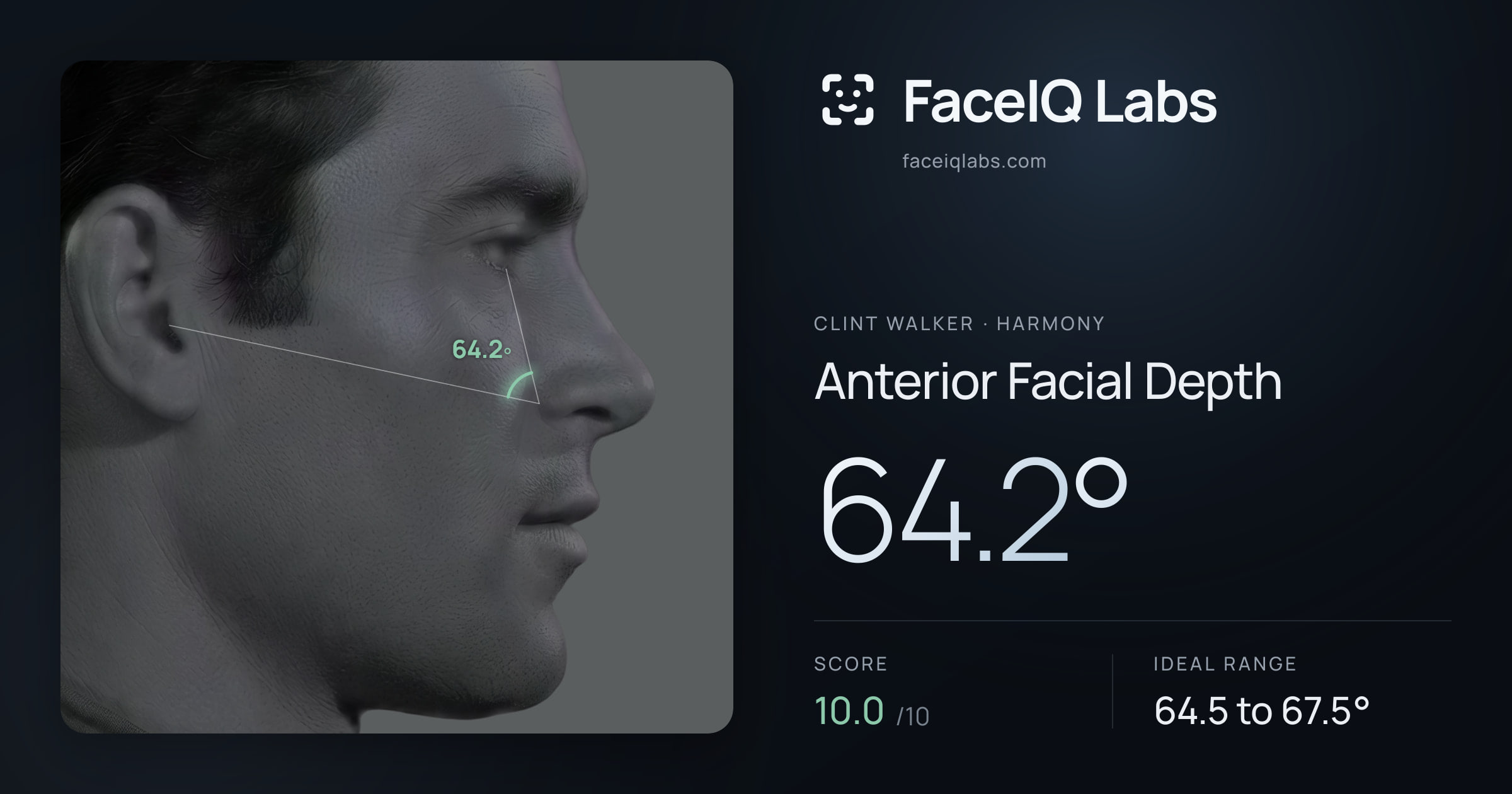 Clint Walker Anterior Facial Depth: 64.2°, drawn on the photo