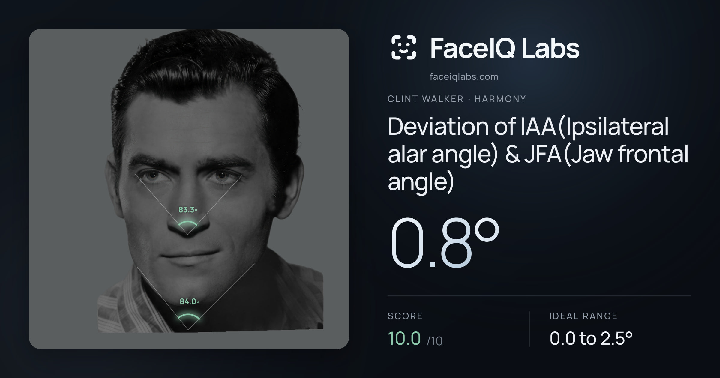 Clint Walker Deviation of IAA(Ipsilateral alar angle) & JFA(Jaw frontal angle): 0.8°, drawn on the photo