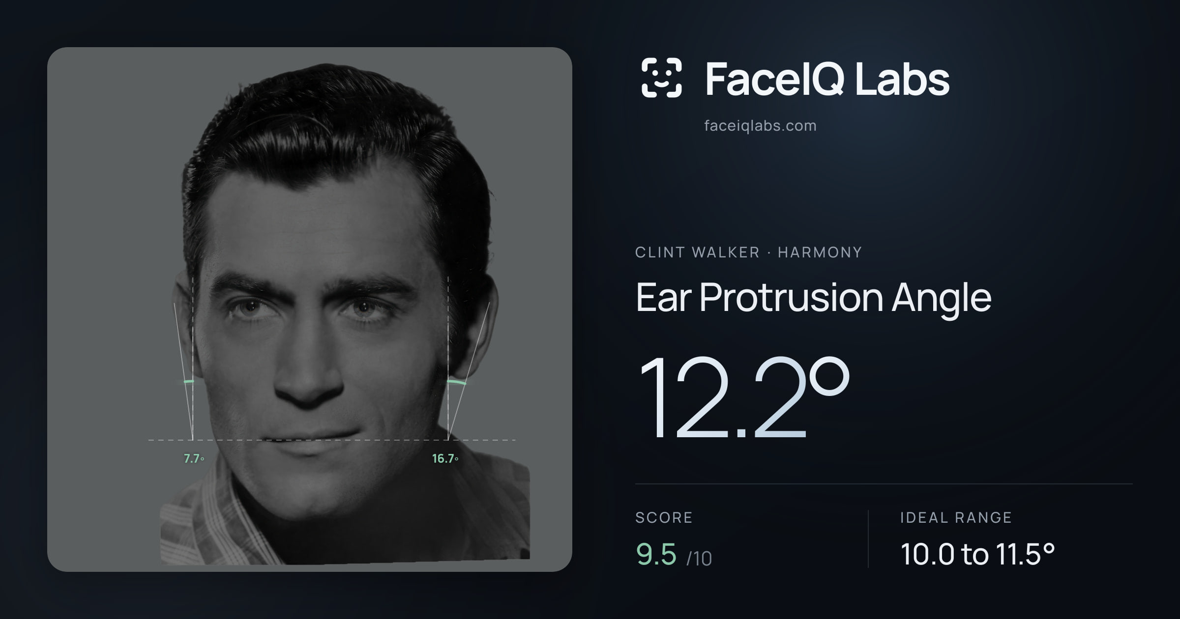Clint Walker Ear Protrusion Angle: 12.2°, drawn on the photo