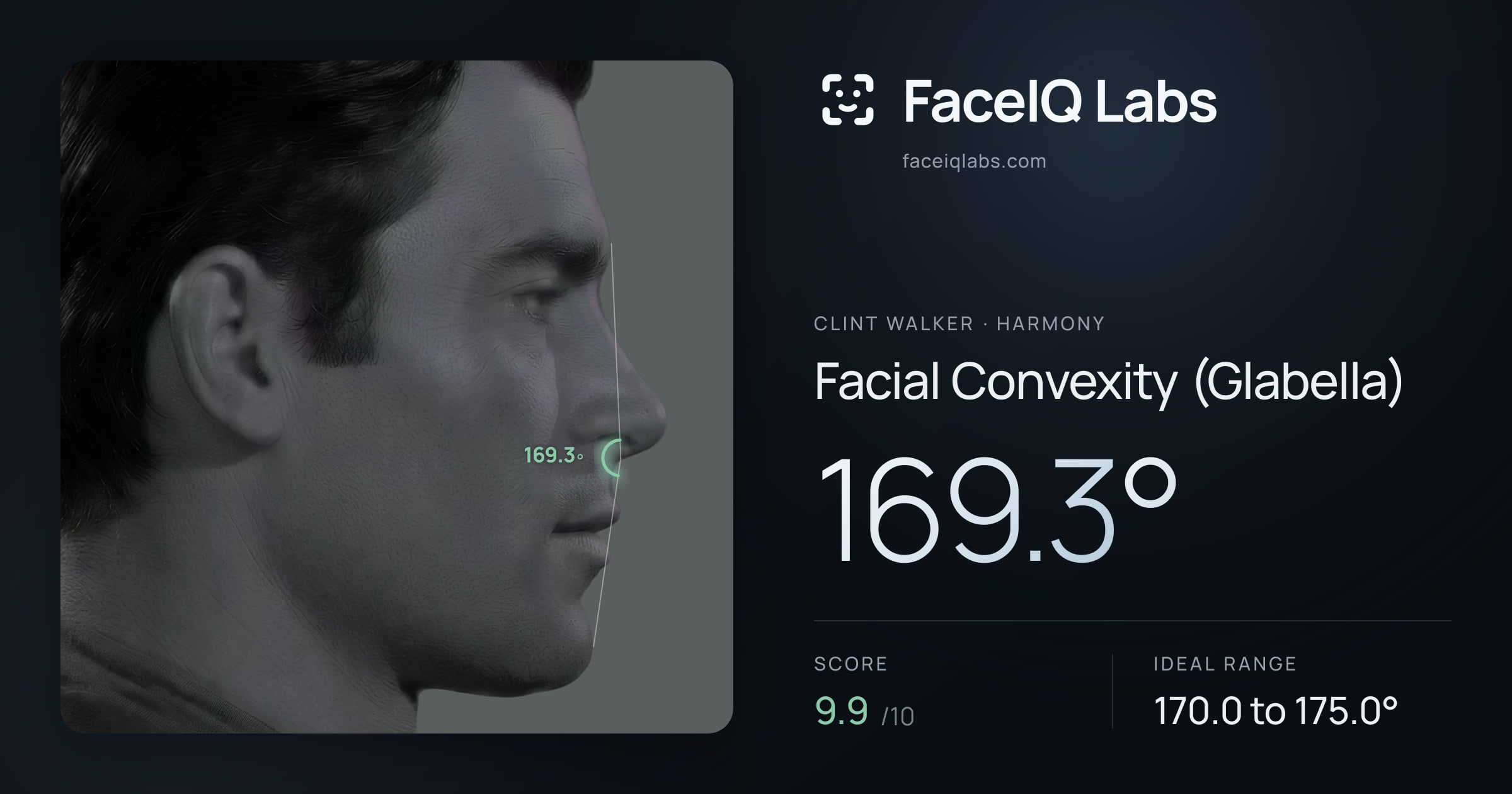 Clint Walker Facial Convexity (Glabella): 169.3°, drawn on the photo