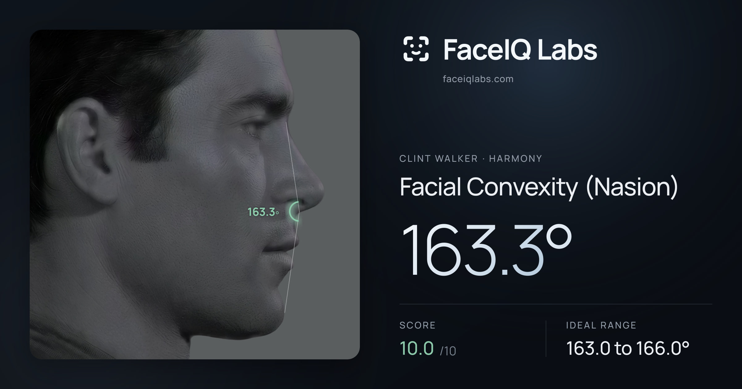 Clint Walker Facial Convexity (Nasion): 163.3°, drawn on the photo