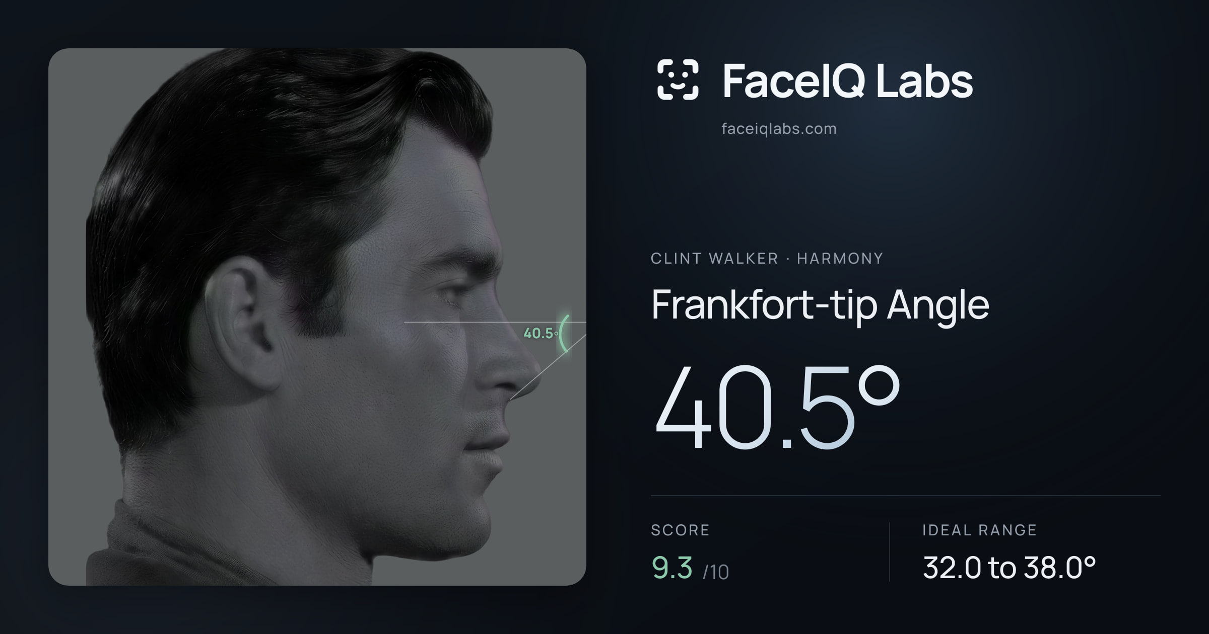 Clint Walker Frankfort-tip Angle: 40.5°, drawn on the photo