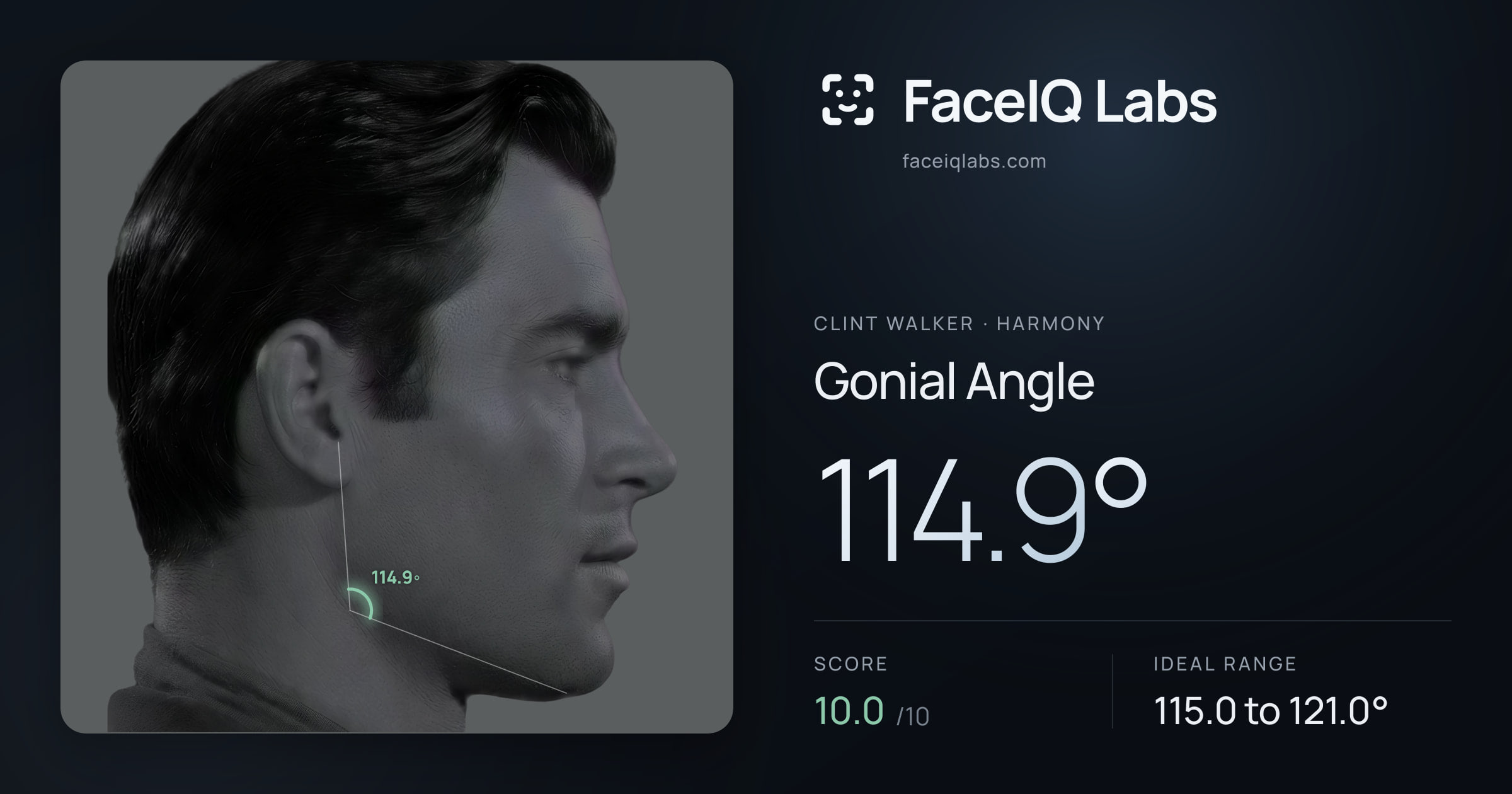Clint Walker Gonial Angle: 114.9°, drawn on the photo