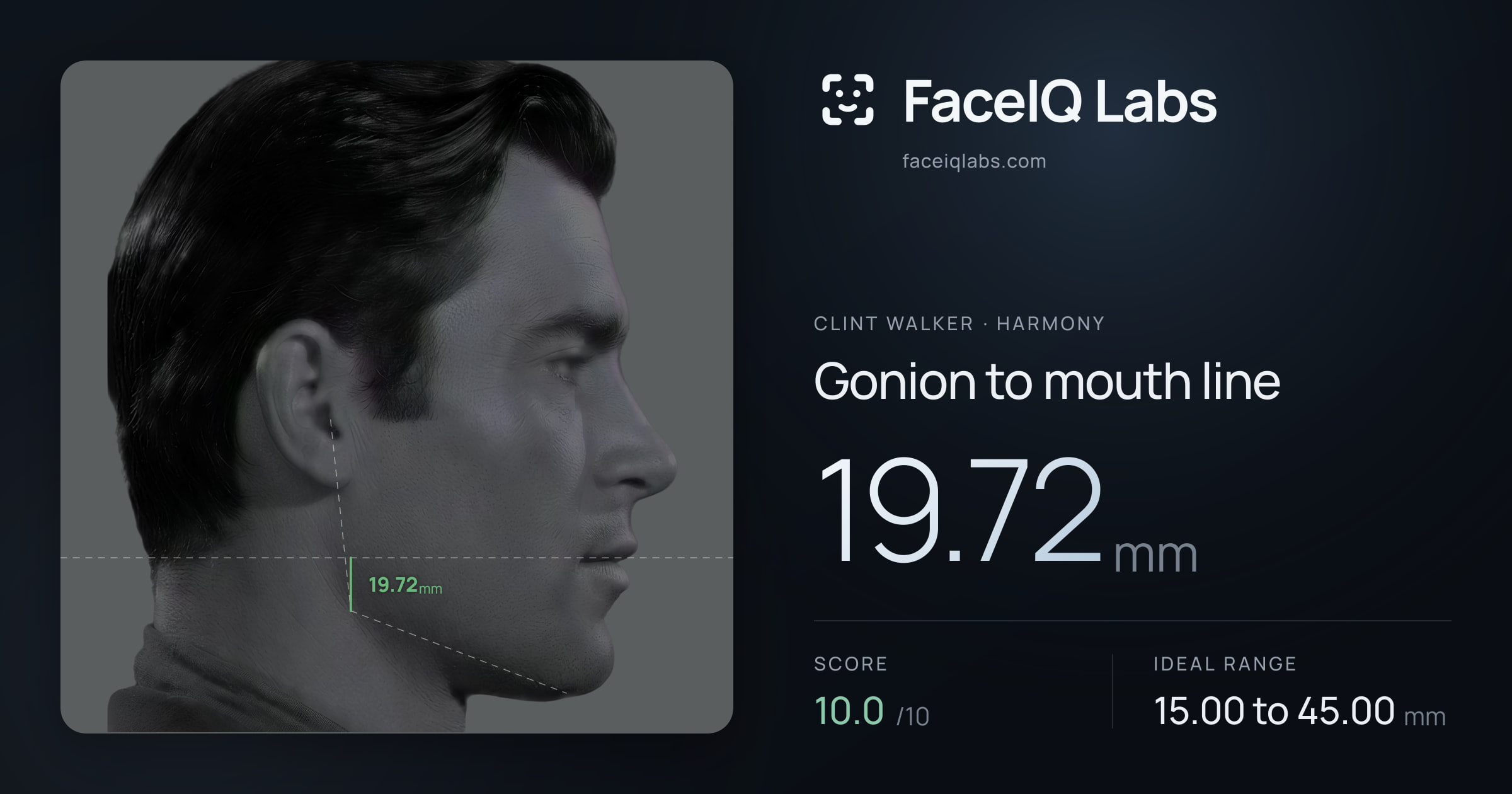 Clint Walker Gonion to mouth line: 19.72mm, drawn on the photo