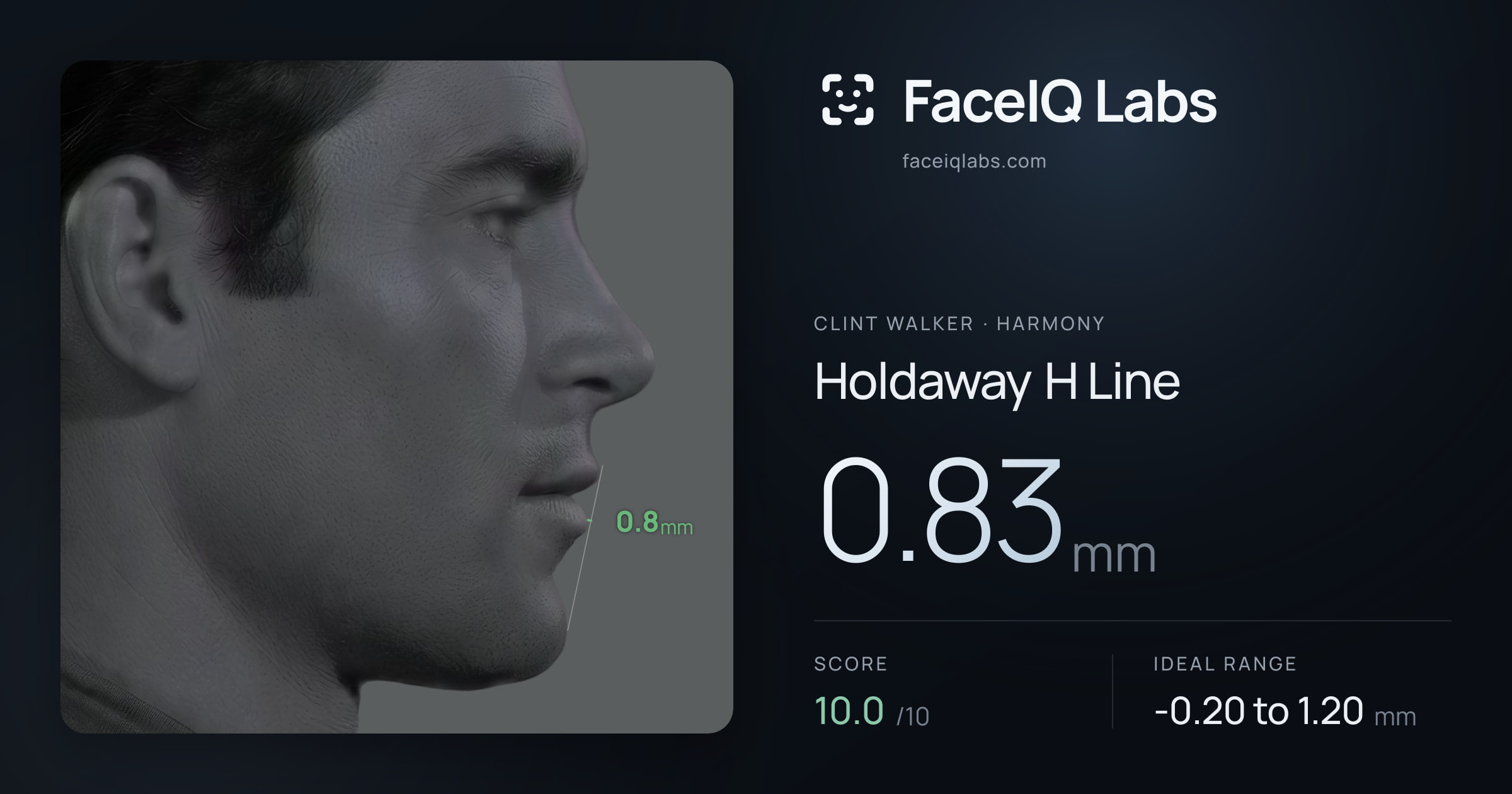 Clint Walker Holdaway H Line: 0.83mm, drawn on the photo