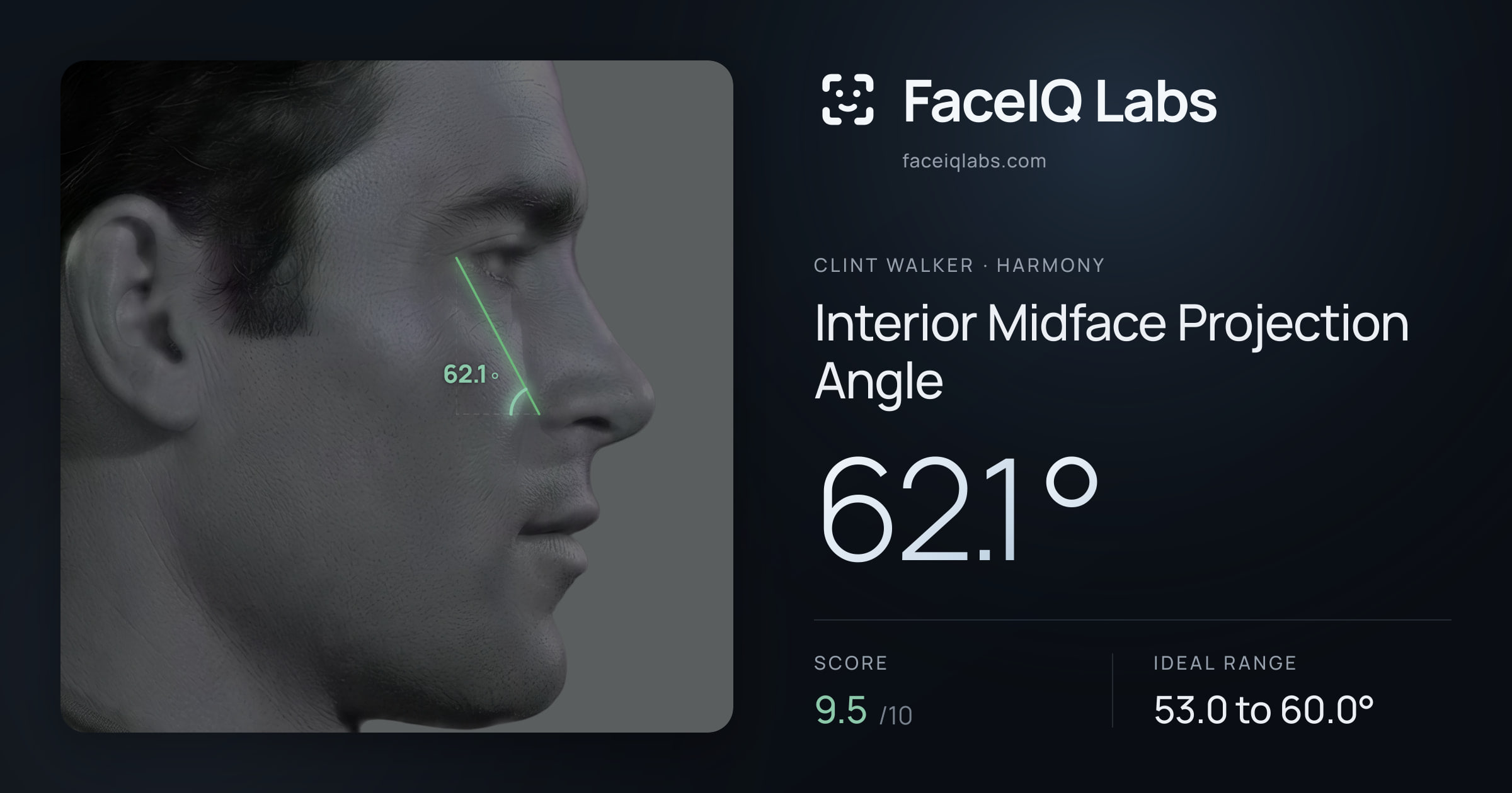 Clint Walker Interior Midface Projection Angle: 62.1°, drawn on the photo