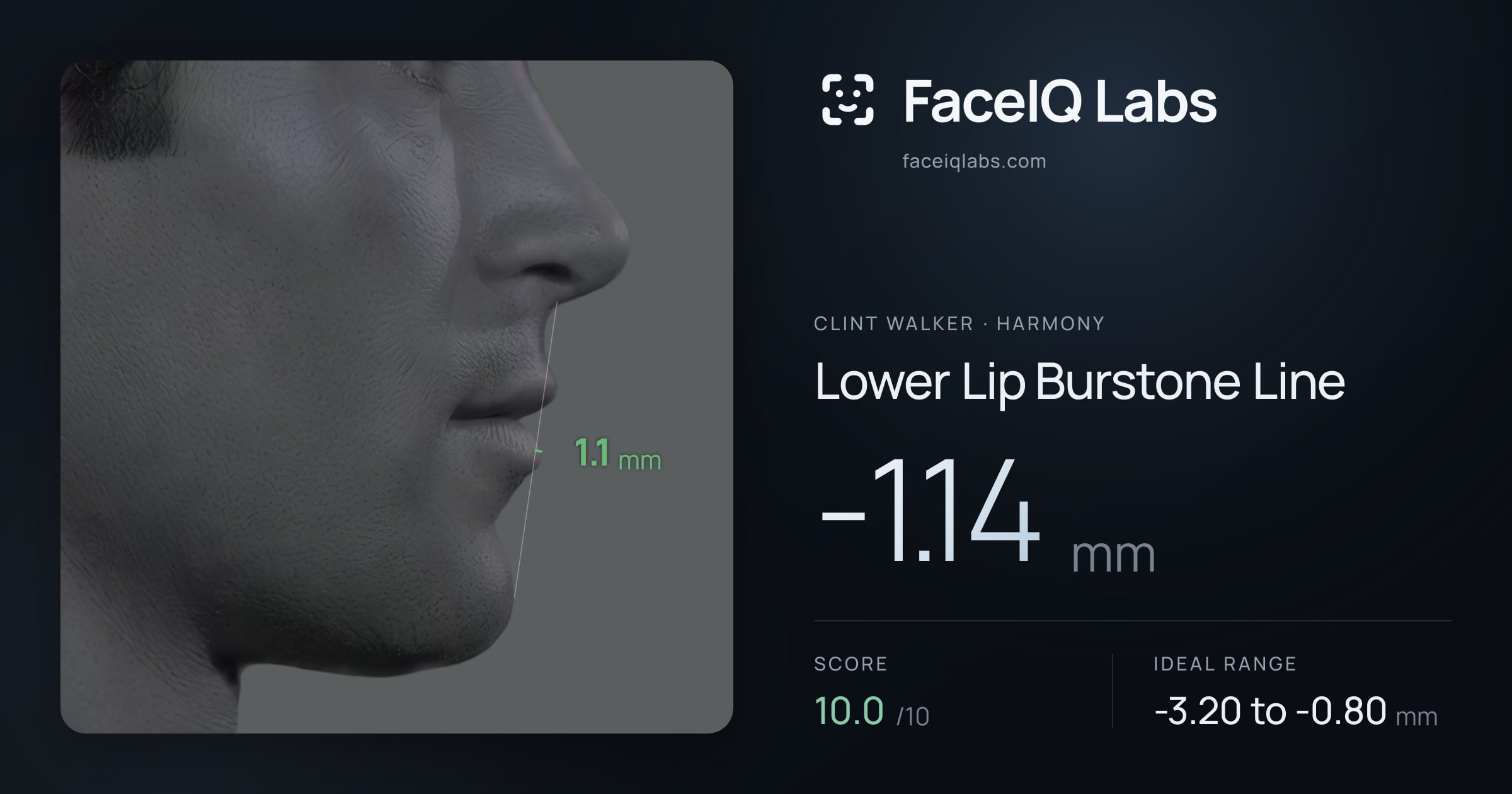 Clint Walker Lower Lip Burstone Line: -1.14mm, drawn on the photo