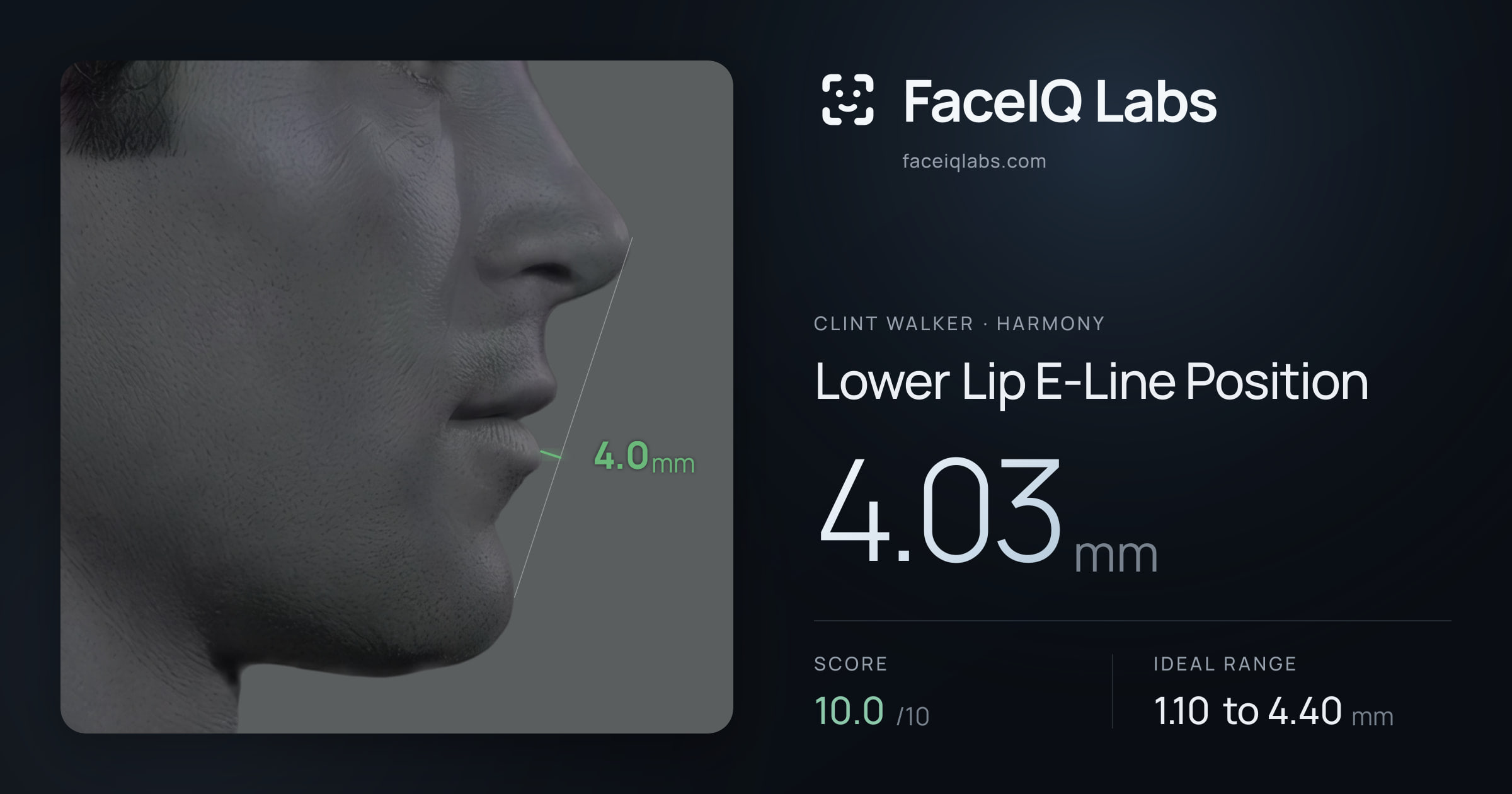 Clint Walker Lower Lip E-Line Position: 4.03mm, drawn on the photo