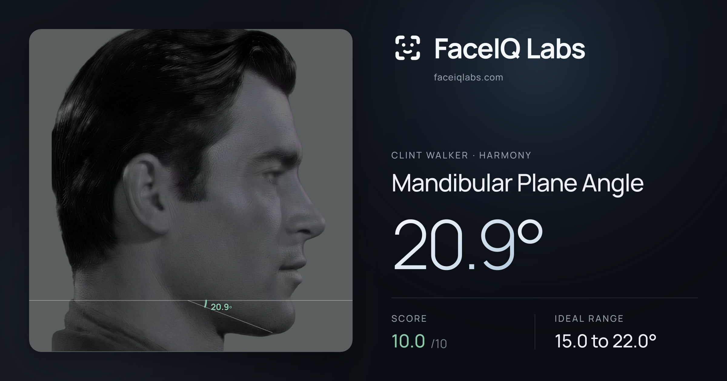 Clint Walker Mandibular Plane Angle: 20.9°, drawn on the photo