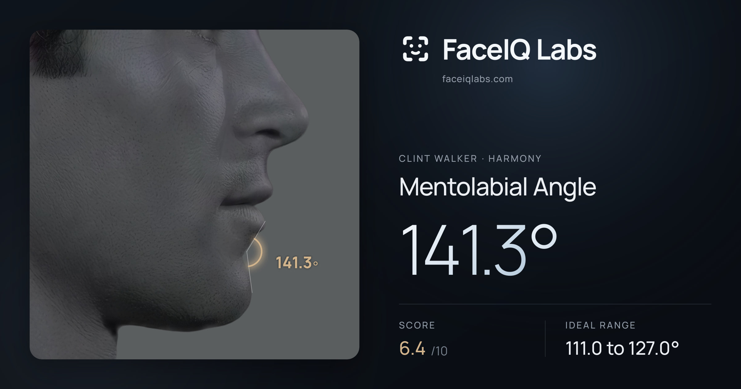 Clint Walker Mentolabial Angle: 141.3°, drawn on the photo