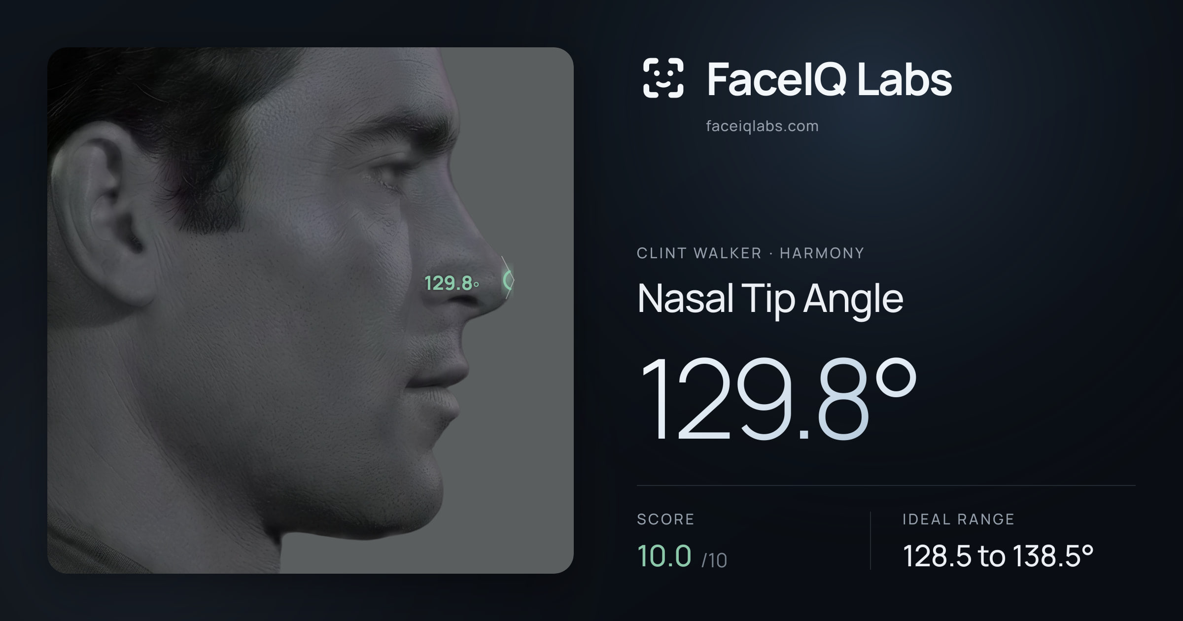 Clint Walker Nasal Tip Angle: 129.8°, drawn on the photo