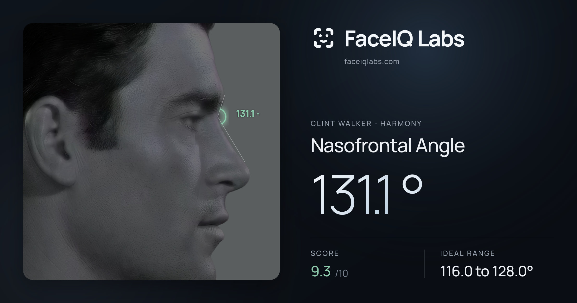 Clint Walker Nasofrontal Angle: 131.1°, drawn on the photo