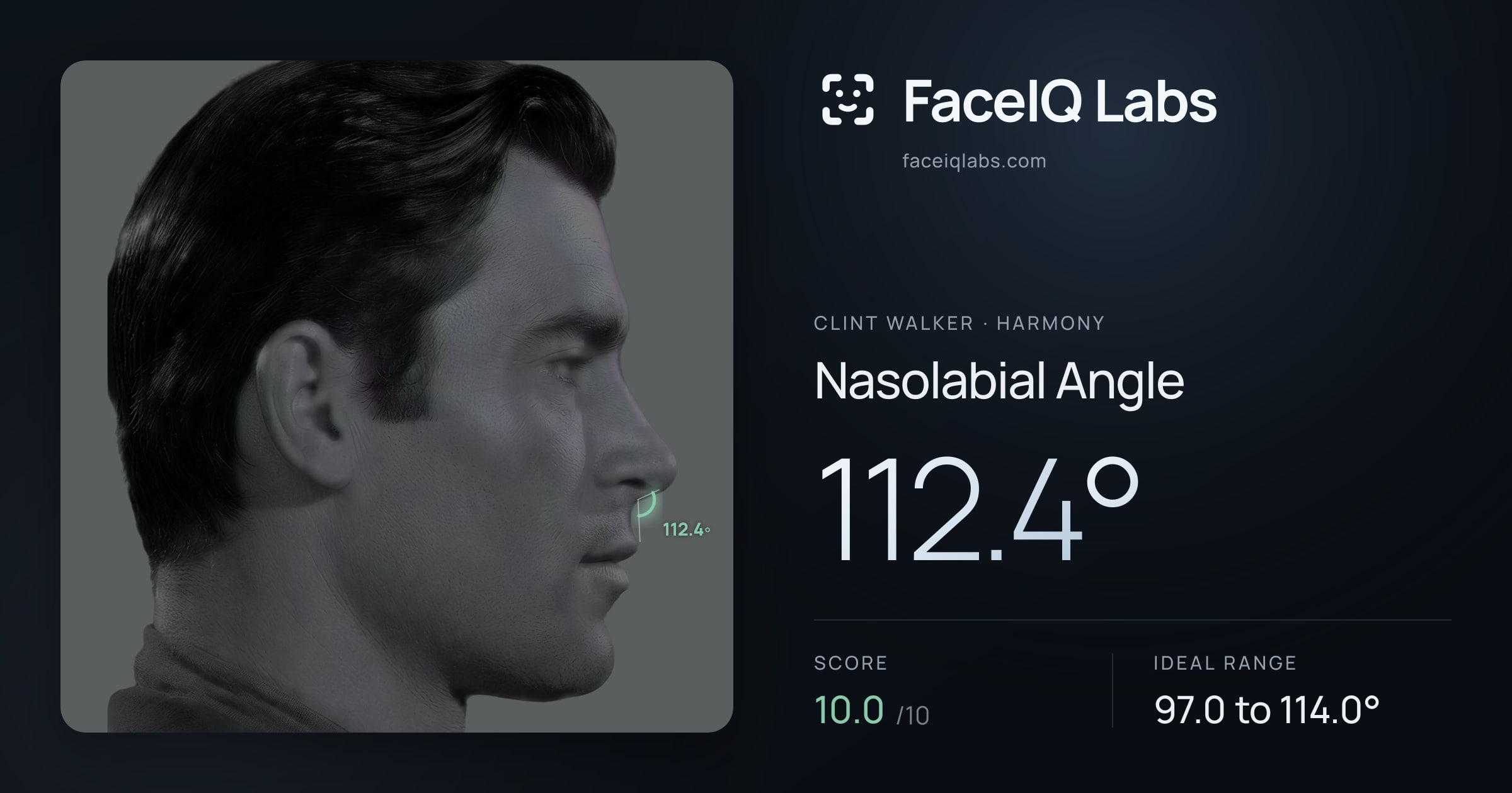 Clint Walker Nasolabial Angle: 112.4°, drawn on the photo