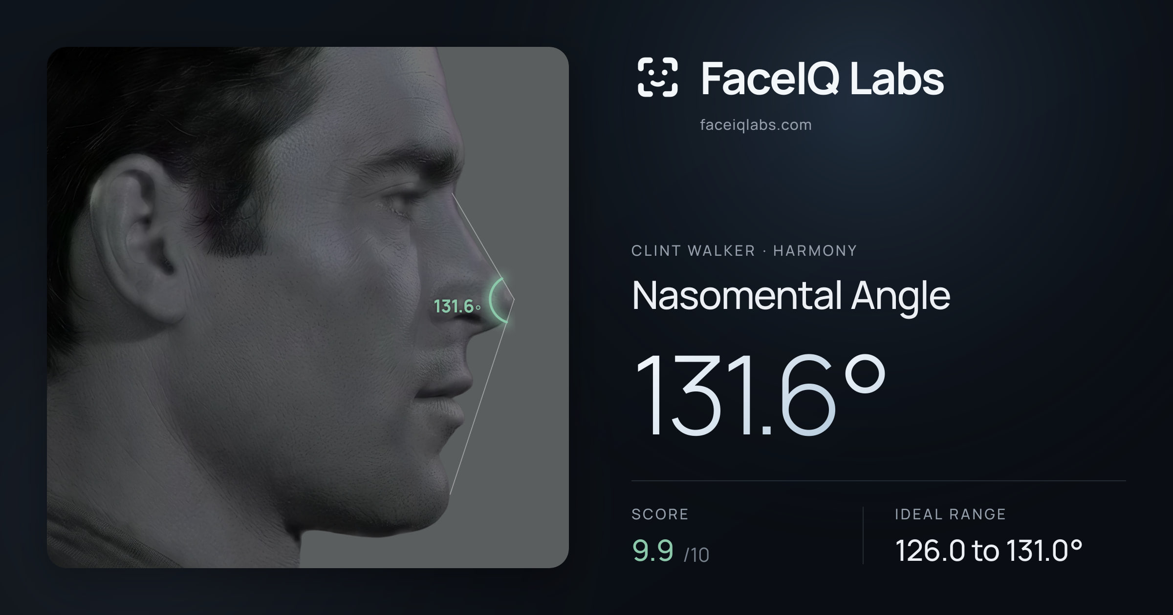 Clint Walker Nasomental Angle: 131.6°, drawn on the photo