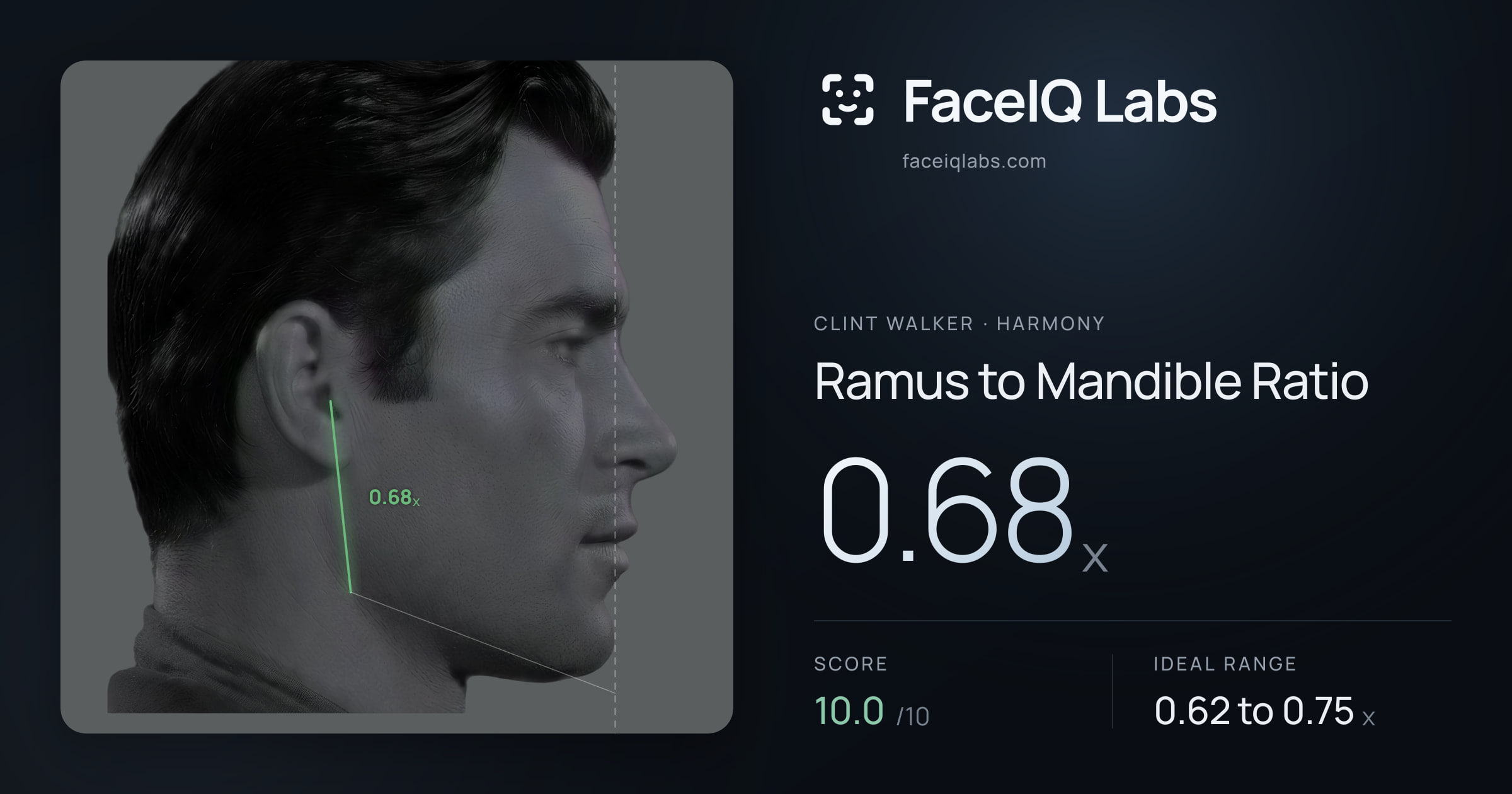 Clint Walker Ramus to Mandible Ratio: 0.68x, drawn on the photo