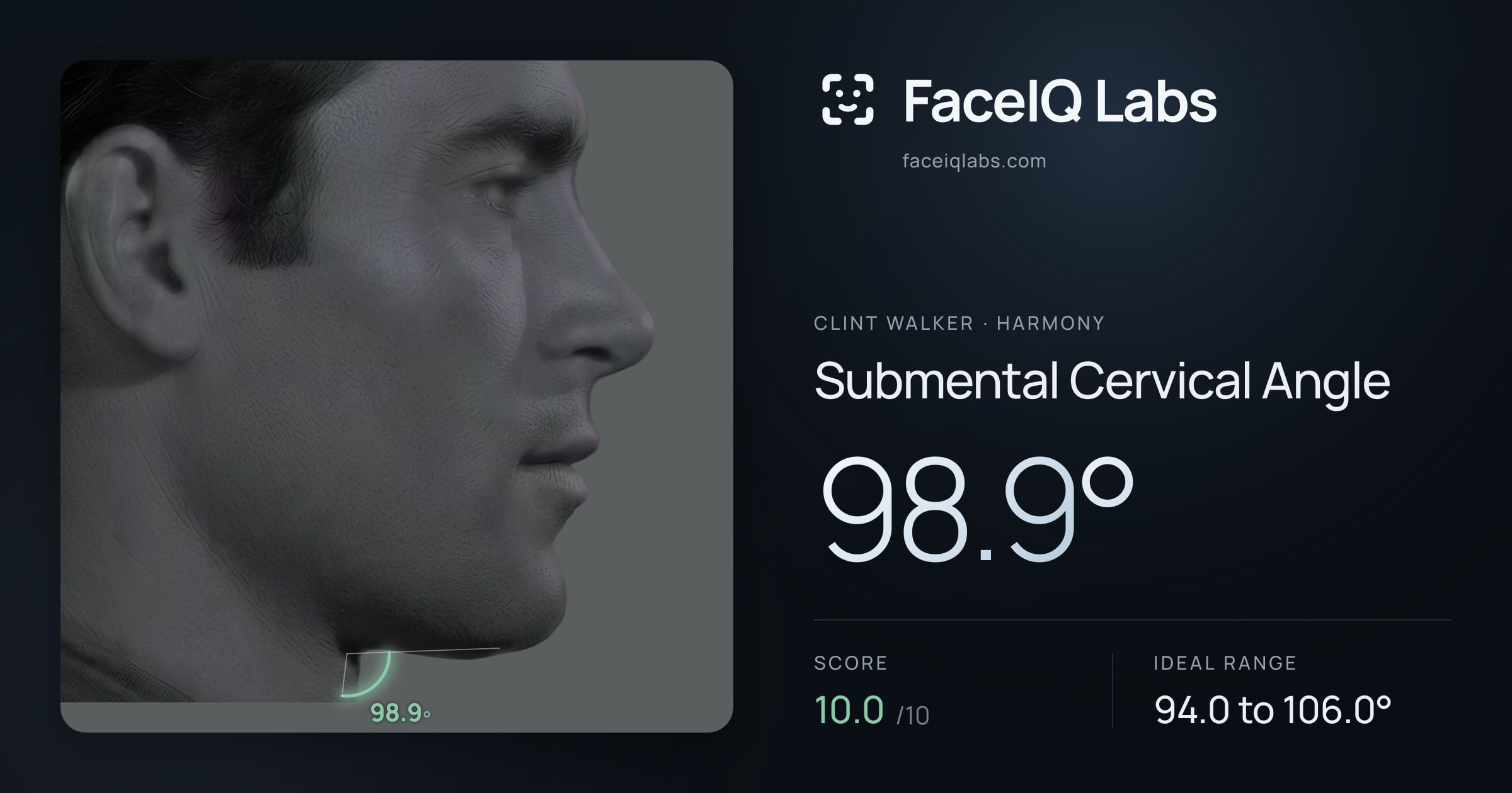 Clint Walker Submental Cervical Angle: 98.9°, drawn on the photo