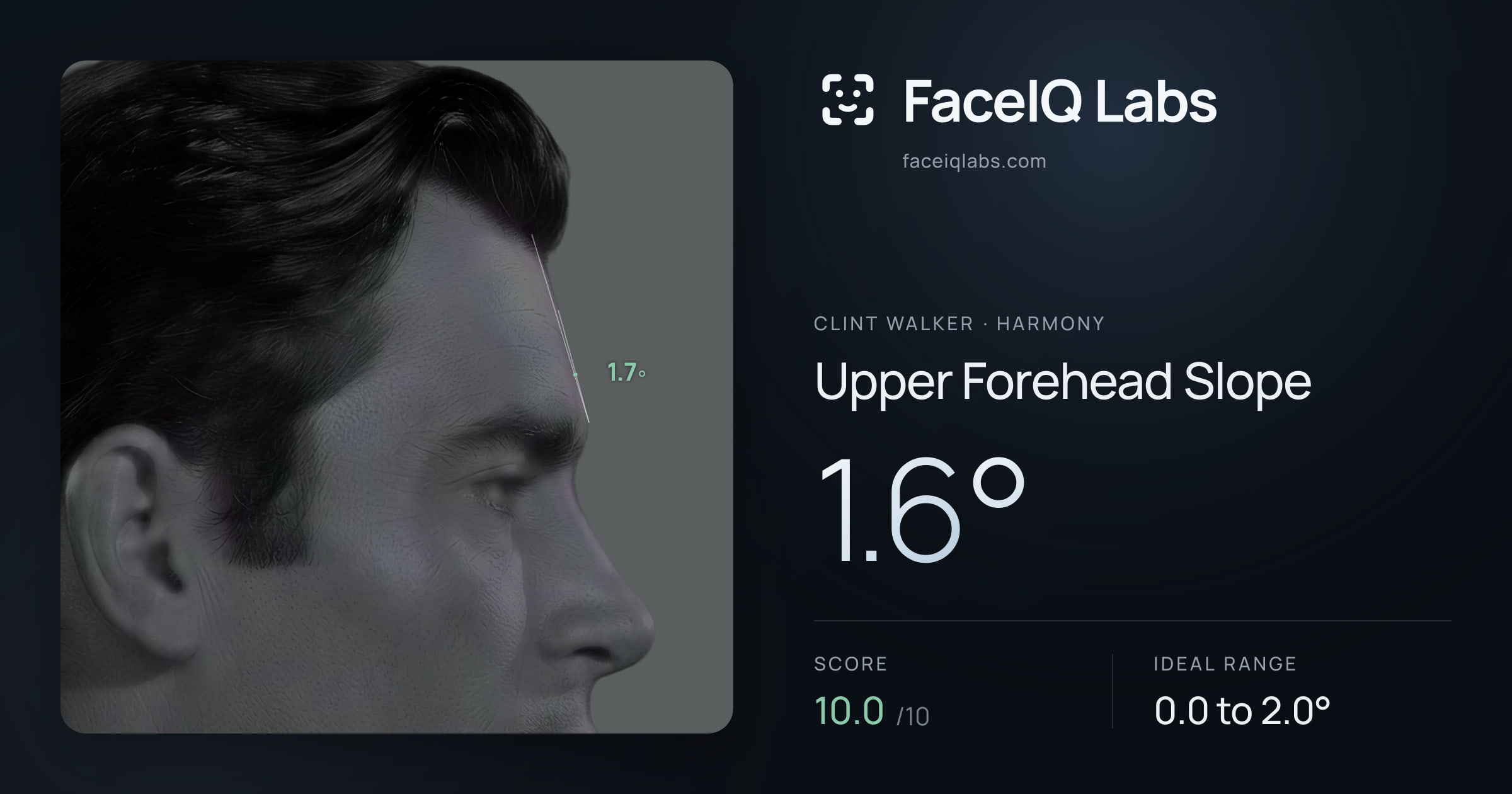 Clint Walker Upper Forehead Slope: 1.6°, drawn on the photo