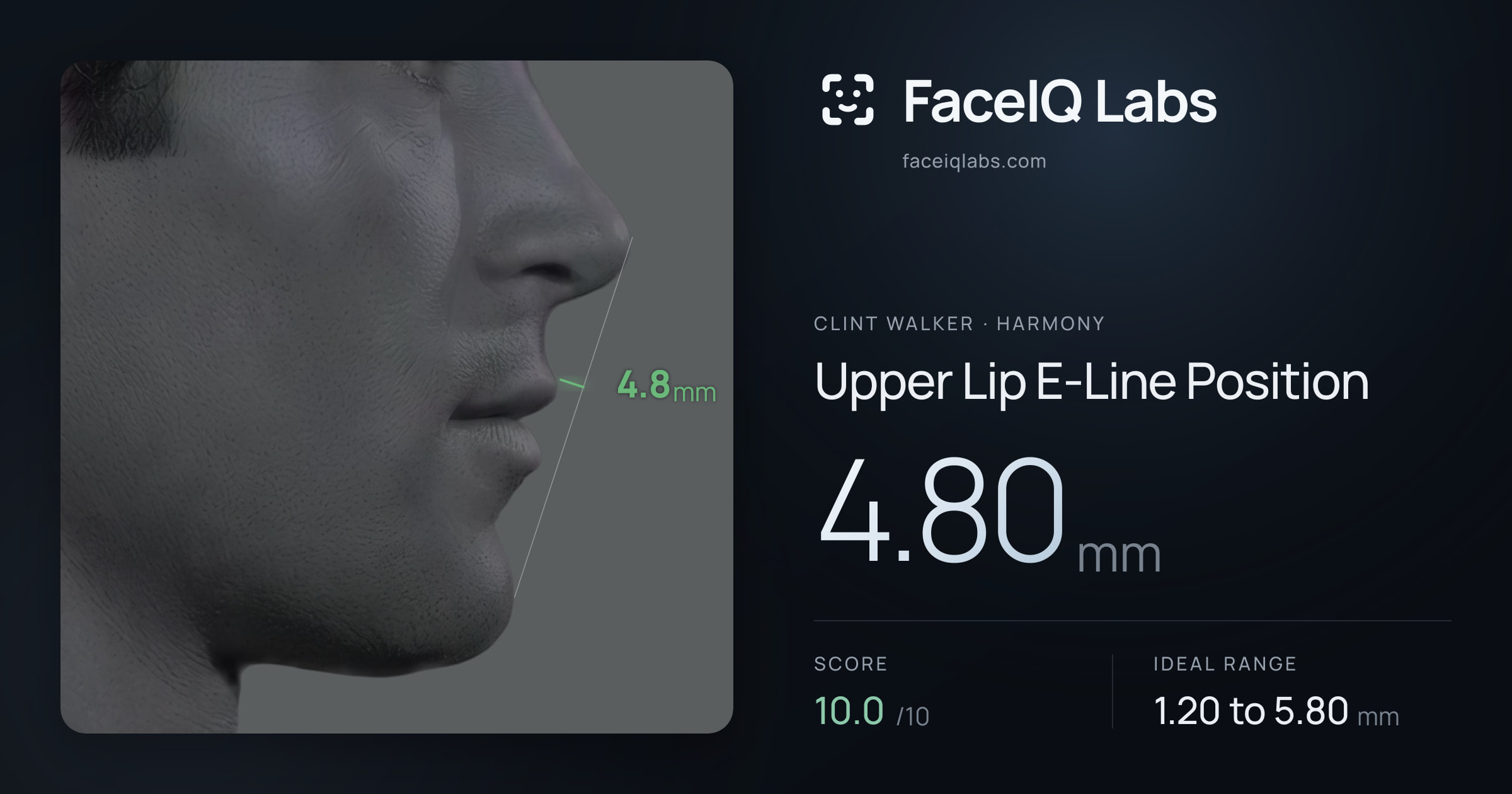 Clint Walker Upper Lip E-Line Position: 4.80mm, drawn on the photo